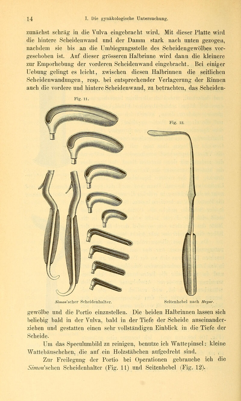zunächst schräg- in die Vulva eingebracht wird. Mit dieser Platte wird die hintere Scheiden wand und der Damm stark nach unten gezogen, nachdem sie bis an die Umbiegungssielle des Scheidengewölbes vor- geschoben ist. Auf dieser grösseren Halbrinne wird dann die kleinere zur Emporhebung der vorderen Scheidenwand eingebracht. Bei einiger Uebung gelingt es leicht, zwischen diesen Halbrinnen die seitlichen Scheidenwandungen, resp. bei entsprechender Verlagerung der Rinnen auch die vordere und hintere Scheidenwand, zu betrachten, das Scheiden- Fio;. 11. Fig. 12. Simon'schev Scheicienlialter. Seitenliebel nach Hegar. gewölbe und die Portio einzustellen. Die beiden Halbrinnen lassen sich beliebig bald in der Vulva, bald in der Tiefe der Scheide auseinander- ziehen und gestatten einen sehr vollständigen Einblick in die Tiefe der Scheide. ,,, Um das Speculumbild zu reinigen, benutze ich Wattepinsel: kleine Wattebäuschchen,; die auf, ein Holzstäbchen aufgedreht sind. ( Zur Freilegung der Portio bei Operationen gebrauche ich die Simon'^oh^^ Scheidenhalter (Fig. 11) und Seitenhebel (Fig. 12).