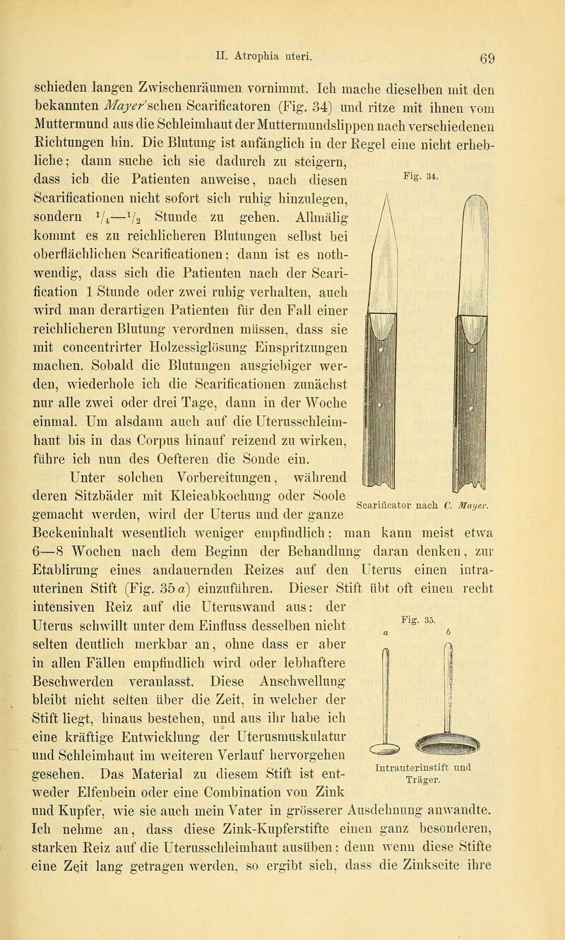 Fig. 34. schieden langen Zwischenräumen vornimmt. Ich mache dieselben mit den bekannten Maj/er'sclien Scarificatoren (Fig. 34) mid ritze mit ihnen vom Muttermund aus die Schleimhaut der Muttermundslippen nach verschiedenen Richtungen hin. Die Blutung ist anfänglich in der Regel eine nicht erheb- liche; dann suche ich sie dadurch zu steigern, dass ich die Patienten anweise, nach diesen Scariticationen nicht sofort sich ruhig hinzulegen, sondern V4—V2 Stunde zu gehen, Allmälig kommt es zu reichlicheren Blutungen selbst bei oberflächlichen Scariticationen; dann ist es noth- wendig, dass sich die Patienten nach der Scari- fication 1 Stunde oder zwei ruhig verhalten, auch wird man derartigen Patienten für den Fall einer reichlicheren Blutung verordnen müssen, dass sie mit concentrirter Holzessiglösung Einspritzungen machen. Sobald die Blutungen ausgiebiger wer- den, wiederhole ich die Scariticationen zunächst nur alle zwei oder drei Tage, dann in der Woche einmal. Um alsdann auch auf die Uterusschleim- haut bis in das Corpus hinauf reizend zu wirken, führe ich nun des Oefteren die Sonde ein. Unter solchen Vorbereitungen, während deren Sitzbäder mit Kleieabkochuug oder Soole gemacht werden, wird der Uterus und der ganze Beckeninhalt wesentlich weniger empfindlich; man kann meist etwa 6—8 Wochen nach dem Beginn der Behandlung daran denken, zur Etablirung eines andauernden Reizes auf den Uterus einen intra- uterinen Stift (Fig. 35 a) einzuführen. Dieser Stift übt oft einen recht intensiven Reiz auf die Uterusw^and aus: der Uterus schwillt unter dem Einfluss desselben nicht selten deutlich merkbar an, ohne dass er aber in allen Fällen empfindlich wird oder lebhaftere Beschwerden veranlasst. Diese Anschwellung bleibt nicht selten über die Zeit, in welcher der Stift liegt, hinaus bestehen, und aus ihr habe ich eine kräftige Entwicklung der Uterusmuskulatur und Schleimhaut im weiteren Verlauf hervorgehen gesehen. Das Material zu diesem Stift ist ent- weder Elfenbein oder eine Gombination von Zink und Kupfer, wde sie auch mein Vater in grösserer Ausdehnung anwandte. Ich nehme an, dass diese Zink-Kupferstifte einen ganz besonderen, starken Reiz auf die Uterusschleimhaut ausüben; denn w^enn diese Stifte eine Zqit lang getragen werden, so ergibt sich, dass die Zinkseite ihre Scarificator nach. C. ßlayer. Fig. 35. Intrauterinstift und Träger.