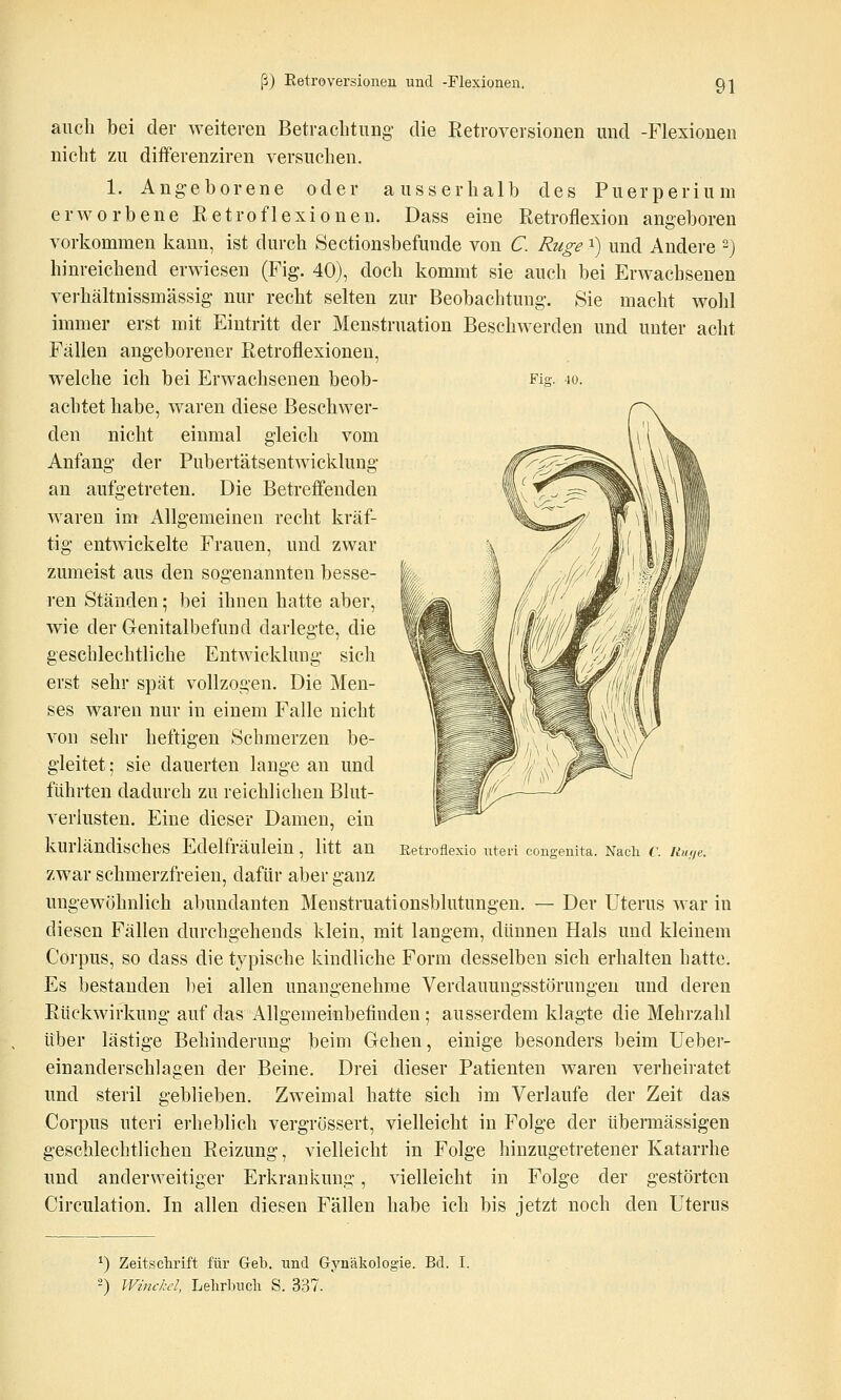 Fig. .10. aucli bei der weiteren Betrachtung die Retroversionen und -Flexionen nicbt zu diiferenziren versuchen. 1. Angeborene oder ausserhalb des Puerperium erworbene Retroflexionen. Dass eine Retrofiexion angeboren vorkommen kann, ist durch Sectionsbefunde von C. Ruge^) und Andere -) hinreichend erwiesen (Fig. 40), doch kommt sie auch bei Erwachsenen verhältnissmässig nur recht selten zur Beobachtung. Sie macht wohl immer erst mit Eintritt der Menstruation Beschwerden und unter acht Fällen angeborener Retroflexionen, welche ich bei Erwachsenen beob- achtet habe, waren diese Beschwer- den nicht einmal gleich vom Anfang der Pubertätsentwicklung an aufgetreten. Die Betreffenden waren im Allgemeinen recht kräf- tig entwickelte Frauen, und zwar zumeist aus den sogenannten besse- ren Ständen; bei ihnen hatte aber, wie der Genitalbefund darlegte, die geschlechtliche Entwicklung sicli erst sehr spät vollzogen. Die Men- ses waren nur in einem Falle nicht von sehr heftigen Schmerzen be- gleitet : sie dauerten lange an und führten dadurch zu reichlichen Blut- verlusten. Eine dieser Damen, ein kurländisches Edelfräulein, litt an zwar schmerzfreien, dafür aber ganz ungewöhnlich abundanten Menstruationsblutungen. — Der Uterus war in diesen Fällen durchgehends klein, mit langem, dünnen Hals und kleinem Coi-pus, so dass die typische kindliche Form desselben sich erhalten hatte. Es bestanden bei allen unangenehme Verdauungsstörungen und deren Rückwirkung auf das Allgemeinbefinden ; ausserdem klagte die Mehrzahl über lästige Behinderung beim Grehen, einige besonders beim Ueber- einanderschlagen der Beine. Drei dieser Patienten waren verheiratet und steril geblieben. Zweimal hatte sich im Verlaufe der Zeit das Corpus uteri erheblich vergrössert, vielleicht in Folge der übermässigen geschlechtlichen Reizung, vielleicht in Folge hinzugetretener Katarrhe und anderweitiger Erkrankung, vielleicht in Folge der gestörten Circulation. In allen diesen Fällen habe ich bis jetzt noch den Uterus Eetroflexio uteri congenita. Nach C. Rufie. *) Zeitschrift für Geb. und Gynäkologie. Bd. I. 2) Winckel, Lehrbuch S. 337.