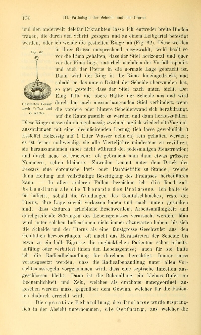 imcl den anderweit deletär Erkrankten lasse ich entweder breite Binden tragen, die durch den Schritt gezogen und an einem Leibgtirtel befestigt werden, oder ich wende die gestielten ßinge an (Fig. 62). Diese werden in ihrer Grösse entsprechend ausgewählt, wohl beölt so vor die Rima gehalten, dass der Stiel horizontal und quer vor der Rima liegt, natürlich nachdem der Vorfall reponirt und auch der Uterus in die normale Lage gebracht ist. Dann wird der Ring in die Rima hineingedrlickt, und sobald er das untere Drittel der Scheide überwunden hat, so quer gestellt, dass der Stiel nach unten sieht. Der Ring füllt die obere Hälfte der Scheide aus und wird Gestie^teTpessar durch den nach aussen hängenden Stiel verhindert, wenn nach vaiieix und ^{q vordere odcr hintere Scheidenwand sich herabdrängt, auf die Kante gestellt zu werden und dann herauszufallen. Diese Ringe müssen durch regelmässig zweimal täglich wiederholte Vaginal- ausspülungen mit einer desinficirenden Lösung (ich lasse gewöhnlich 3 Esslöffel Holzessig auf 1 Liter Wasser nehmen) rein gehalten werden; es ist ferner nothwendig, sie alle Vierteljahre mindestens zu revidiren, sie herauszunehmen (aber nicht während der jedesmaligen Menstruation) und durch neue zu ersetzen; oft gebraucht man dann etwas grössere Nummern, selten kleinere. Zuweilen kommt unter dem Druck des Pessars eine chronische Peri- oder Parametritis zu Stande, welche dann Heilung und vollständige Beseitigung des Prolapses herbeiführen kann» — In allen anderen Fällen bezeichne ich die Radical- b e h a n d 1 u n g als die Therapie des Prolapses. Ich halte sie für indicirt, sobald die Wandungen des Genitalschlauches, resp. der Uterus, ihre Lage soweit verlassen haben und nach unten gesunken sind, dass dadurch erhebliche Beschwerden, Arbeitsunfähigkeit und durchgreifende Störungen des Lebensgenusses verursacht werden. Man wird unter solchen Indicationen nicht immer abzuwarten haben, bis sich die Scheide und der Uterus als eine faustgrosse Geschwulst aus den Genitalien hervordrängen, oft macht das Heraustreten der Scheide bis etwa zu ein halb Eigrösse die unglücklichen Patienten schon arbeits- unfähig oder verbittert ihnen den Lebensgenuss; auch für sie halte ich die Radicalbehandlung für durchaus berechtigt. Immer muss vorausgesetzt werden, dass die Radicalbehandlung unter allen Vor- sichtsmassregeln vorgenommen wird, dass eine septische Infection aus- geschlossen bleibt. Dann ist die Behandlung ein kleines Opfer an Bequemlichkeit und Zeit, welches als durchaus untergeordnet an- gesehen werden muss, gegenüber dem Gewinn, welcher für die Patien- ten dadurch erreicht wird. Die operative Behandlung d e r P r o 1 a p s e wurde ursprüng- lich in der Absicht unternommen, die Oeffnung, aus welcher die
