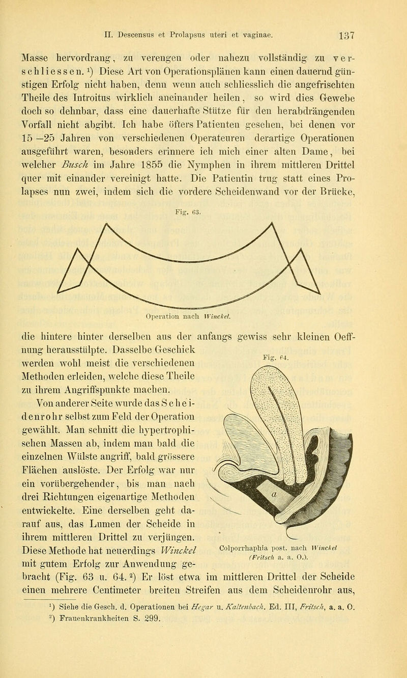 Masse hervordrang, zu verengen oder nahezu vollständig zu ver- schliessen. 1) Diese Art von Operationsplänen kann einen dauernd gün- stigen Erfolg nicht haben, denn wenn auch schliesslich die angefrischten Theile des Introitus wirklich aneinander heilen, so wird dies Gewebe doch so dehnbar, dass eine dauerhafte Stütze für den herabdrängenden Vorfall nicht abgibt. Ich habe öfters Patienten gesehen, bei denen vor 15 —25 Jahren von verschiedenen Operateuren derartige Operationen ausgeführt waren, besonders erinnere ich mich einer alten Dame, bei welcher Busch im Jahre 1855 die Nymphen in ihrem mittleren Drittel quer mit einander vereinigt hatte. Die Patientin trug statt eines Pro- lapses nun zwei, indem sich die vordere Scheidenwand vor der Brücke, Fig. 63. Mg. P4. Operation nach WincJiel, die hintere hinter derselben aus der anfangs gewiss sehr kleinen Oefif- nung herausstülpte. Dasselbe Geschick werden wohl meist die verschiedenen Methoden erleiden, weiche diese Theile zu ihrem Angriffspunkte machen. Von anderer Seite wurde das S c h e i- denrohr selbst zum Feld der Operation gewählt. Man schnitt die hypertrophi- schen Massen ab, indem man bald die einzelnen Wülste angrifi, bald grössere Flächen auslöste. Der Erfolg war nur ein vorübergehender, bis man nach drei Richtungen eigenartige Methoden entwickelte. Eine derselben geht da- rauf aus, das Lumen der Scheide in ihrem mittleren Drittel zu verjüngen. Diese Methode hat neuerdings Winckel mit gutem Erfolg zur Anwendung ge- bracht (Fig. 63 u. 64.2) Er löst etwa im mittleren Drittel der Scheide einen mehrere Centimeter breiten Streifen aus dem Scheidenrohr aus, *) Siehe die Gesch. d. Operationen bei Hegar u. Kaltenbach. Ed. III, Fritsch^ a. a. 0. ^) Frauenkrankheiten S. 299. Colporrhaphia post. nach Winckel (Fritsch a. a. 0.).