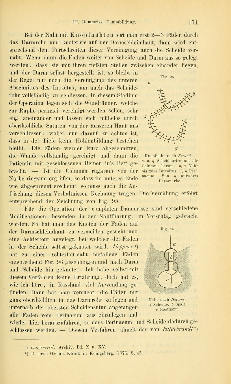 Fie. 95. ^ >^ '^^ ^-^ 7; k >$< y Knopfnaht nacli Frennd. o, p, (/ Sclieidenriss um die Columna herum. }?, : Naht Bei der Naht mit Knopf nähten legt man erst 2—3 Fäden dm'ch das Darmrohr und knotet sie auf der Darmschleimhaut, dann wird ent- sprechend dem Fortschreiten dieser Vereinigung auch die Scheide ver- näht. Wenn dann die Fäden weiter von Scheide und Darm aus so gelegt Averden, dass sie mit ihren tiefsten Stellen zwischen einander liegen, und der Darm selbst hergestellt ist, so bleibt in der Regel nur noch die Vereinigung des unteren Abschnittes des Introitus, um auch das Scheide- rohr vollständig zu schliessen. In diesem Stadium der Operation legen sich die Wundränder, welche zur Raphe perinaei vereinigt werden sollen, sehr eng aneinander und lassen sich mühelos durch oberflächliche Suturen von der äusseren Haut aus verschliessen, wobei nur darauf zu achten ist, xlass in der Tiefe keine Höhlenbildung bestehen bleibt. Die Fäden werden kurz abgeschnitten, die Wunde vollständig gereinigt und dann die Patientin mit geschlossenen Beinen in's Bett ge- bracht. — Ist die Columna rugarum von der Ms zum introitus. :, y Peii- -vTi- '£c IM i. TT'J naeum. Von y aufwärts Narbe ringsum ergrilten, so dass ihr unteres Lnde Darmnarbe wie abgesprengt erscheint, so muss auch die An- frischung diesen Verhältnissen Rechnung tragen. Die Vernähung erfolgt entsprechend der Zeichnung von Fig. 95. Für die Operation der completen Dammrisse sind verschiedene Modificationen, besonders in der Nahtführung, in Vorschlag gebracht worden. So hat man das Knoten der Fäden auf der Darmschleimhaut zu vermeiden gesucht und eine Achtertour angelegt, bei welcher der Faden in der Scheide selbst geknotet wird. Heppner^) hat zu einer Achtertournaht metallene Fäden entsprechend Fig. 9i) geschlungen und nach Darm und Scheide hin geknotet. Ich habe selbst mit diesem Verfahren keine Erfahrung, doch hat es, wie ich höre, in Russland viel Anwendung ge- funden. Dann hat man versucht, die Fäden nur ganz oberflächlich in das Darmrohr zu legen und unterhalb der obersten Scheidensutur angefangen alle Fäden vom Perinaeum aus einzulegen und wieder hier herauszuführen, so dass Perinaeum und Scheide dadurch ge schlössen werden. — Diesem Verfahren ähnelt das von Hildebrandt \ Fig. 96. Naht nach Heppner. a Scheide, b Spalt, c Mastdarm. ') Langcnbeck's Archiv, Bd. X u. XV. '•*) D. neue Grynäk.-Klinik in Königsberg. 1876, S. 45.