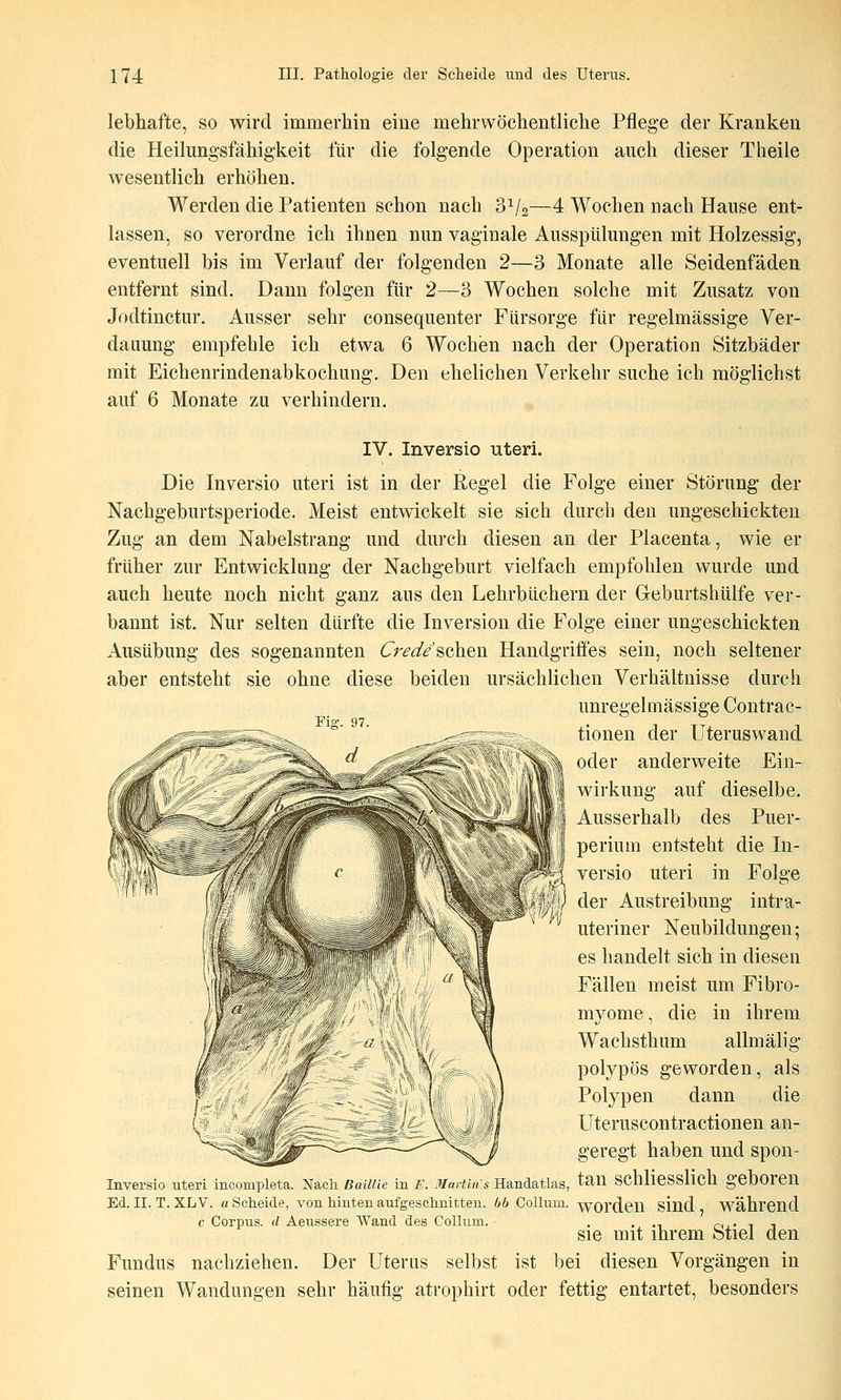 lebhafte, so wird immerhin eine mehrvvöchentliche Pflege der Kranken die Heilungsfähig'keit für die folgende Operation auch dieser Theile wesentlich erhöhen. Werden die Patienten schon nach 3^/2—4 Wochen nach Hanse ent- lassen, so verordne ich ihnen nun vaginale Ausspülungen mit Holzessig, eventuell bis im Verlauf der folgenden 2—3 Monate alle Seidenfäden entfernt sind. Dann folgen für 2—3 Wochen solche mit Zusatz von Jodtinctur. Ausser sehr consequenter Fürsorge für regelmässige Ver- dauung empfehle ich etwa 6 Wochen nach der Operation Sitzbäder mit Eichenrindenabkochung. Den ehelichen Verkehr suche ich möglichst auf 6 Monate zu verhindern. IV. Inversio uteri. Die Inversio uteri ist in der Regel die Folge einer Störung der Nachgeburtsperiode. Meist entwickelt sie sich durch den ungeschickten Zug an dem Nabelstrang und durch diesen an der Placenta, wie er früher zur Entwicklung der Nachgeburt vielfach empfohlen wurde und auch heute noch nicht ganz aus den Lehrbüchern der G-eburtshülfe ver- bannt ist. Nur selten dürfte die Inversion die Folge einer ungeschickten Ausübung des sogenannten Creäeschen Handgriffes sein, noch seltener aber entsteht sie ohne diese beiden ursächlichen Verhältnisse durch unregelmässige Contrac- tionen der Uteruswand oder anderweite Ein- wirkung auf dieselbe. Ausserhalb des Puer- perium entsteht die In- versio uteri in Folge der Austreibung intra- uteriner Neubildungen; es handelt sich in diesen Fällen meist um Fibro- myome, die in ihrem Wachsthum allmälig polypös geworden, als Polypen dann die Uteruscontractionen an- geregt haben und spon- Inversio uteri inconipleta. ^STacli Baillie in E. Martin sB.a.nia,Üas, tan SChlieSSllCtl geboren Ed. II. T. XL V. a Scheide, von hinten aufgeschnitten. 66 Collum, worden sind während c Corpus, d Aeussere Wand des Collum. . . .i n,- i -i Sie mit ihrem Stiel den Fundus nachziehen. Der Uterus selbst ist bei diesen Vorgängen in seinen Wandungen sehr häufig atrophirt oder fettig entartet, besonders