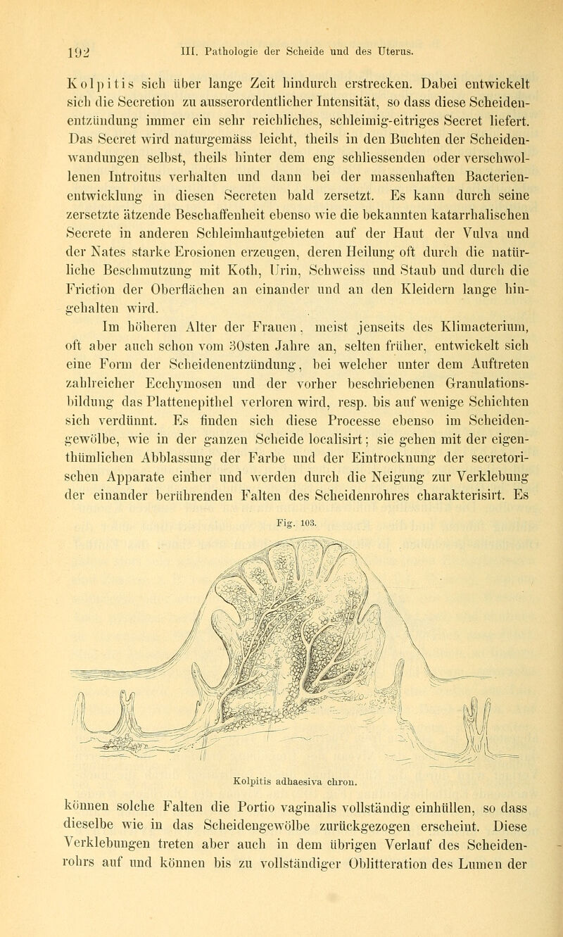 Kolpitis sich über lange Zeit hindurch erstrecken. Dabei entwickelt sich die Secretion zu ausserordentlicher Intensität, so dass diese Scheiden- entzündung- immer ein sehr reichliches, schleimig-eitriges Secret liefert. Das Secret wird naturgemäss leicht, theils in den Buchten der Scheiden- wandungen selbst, theils hinter dem eng schliessenden oder verschwol- lenen Introitus verhalten und dann bei der massenhaften Bacterien- entwicklung in diesen Secreten bald zersetzt. Es kann durch seine zersetzte ätzende Beschaffenheit ebenso wie die bekannten katarrhalischen Secrete in anderen Schleimhautgebieten auf der Haut der Vulva und der Nates starke Erosionen erzeugen, deren Heilung oft durch die natür- liche Beschmutzung mit Koth, Urin, Schweiss und Staub und durch die Friction der Oberflächen an einander und an den Kleidern lange hin- gehalten wird. Im höheren Alter der Frauen, meist jenseits des Klimacterium, oft aber auch schon vom 30sten Jahre an, selten früher, entwickelt sich eine Form der Scheidenentzündung, bei welcher unter dem Auftreten zahlreicher Ecchymosen und der vorher beschriebenen Granulations- bildung das Plattenepithel verloren wird, resp. bis auf wenige Schichten sich verdünnt. Es finden sich diese Processe ebenso im Scheiden- gewölbe, wie in der ganzen Scheide localisirt; sie gehen mit der eigen- thümlichen Abblassung der Farbe und der Eintrocknung der secretori- schen Apparate eirfher und werden dm-ch die Neigung zur Verklebung der einander berührenden Falten des Scheidenrohres charakterisirt. Es Fis. 103. l / / \\ Kolpitis adhaesiva cliron. können solche Falten die Portio vaginalis vollständig einhüllen, so dass dieselbe wie in das Scheidengewölbe zurückgezogen erscheint. Diese Verklebungen treten aber auch in dem übrigen Verlauf des Scheiden- rohrs auf und können bis zu vollständiger Oblitteration des Lumen der