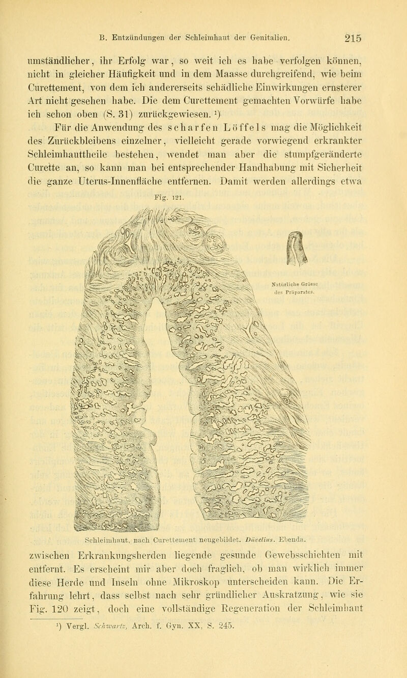 umständlicher, ihr Erfolg war, so weit ich es habe verfolgen können, nicht in gleicher Häufigkeit und in dem Maasse durchgreifend, wie beim Curettement, von dem ich andererseits schädliche Einwirkungen ernsterer Art nicht gesehen habe. Die dem Curettement gemachten Vorwürfe habe ich schon oben (S. 31) zurückgewiesen. ^) Für die Anwendung des scharfen Löffe 1 s mag die Möglichkeit des Zurückbleibens einzelner, vielleicht gerade vorwiegend erkrankter Schleimhauttheile bestehen, wendet man aber die stumpfgeränderte Curette an, so kann man bei entsprechender Handhabung mit Sicherheit die ganze Uterus-Innenfläche entfernen. Damit werden allerdings etwa Fiff. 121. Nnturliclie Grösse äe- Puparates. ■—VC ^ '■S r^Zi \ j*« ^ ^ ^- —' i \\ . Schleimhaut, nach Curettement neugehildet. Diivelius. Ebenda. zwischen Erkrankungsherden liegende gesunde Gewebsschichten mit entfernt. Es erscheint mir aber doch fraglich, ob man wirklich immer diese Herde und Inseln ohne Mikroskop unterscheiden kann. Die Er- fahrung lehrt, dass selbst nach sehr gründlicher Auskratzung, wie sie Fig. 120 zeigt, doch eine vollständige Regeneration der Schleimhaut 1) Vergl. Schwarts, Arch. f. Gyn. XX, S. 245.