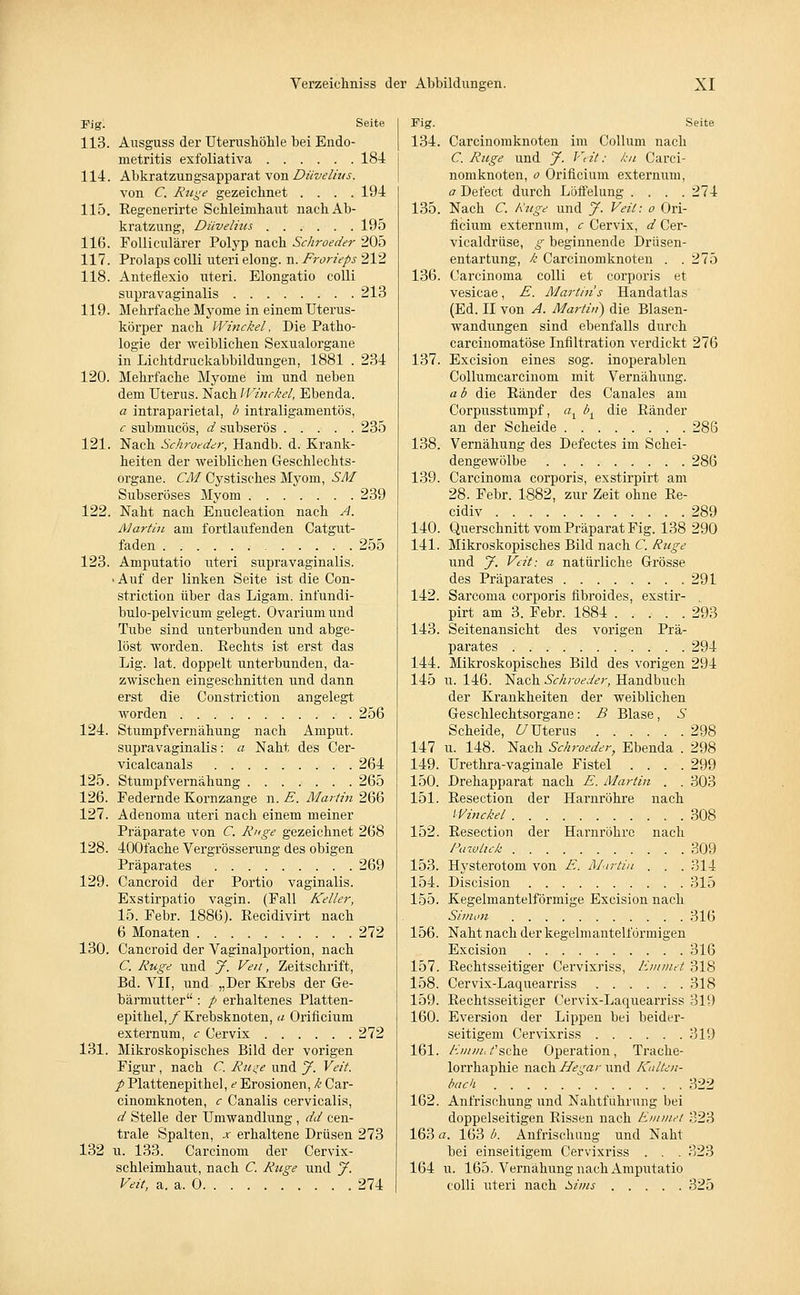 Fig. Seite 113. Ausguss der Uterushöhle bei Endo- metritis exfoliativa 184 114. Abkratzungsapparat von Düvelit/s. von C. Rüge gezeichnet . . . .194 115. Regenerirte Schleimhaut nach Ab- kratzung, Düvelms, 195 116. Folliculärer Polyp nach Schroeder 205 117. Prolaps colli uteri elong. n. Frorieps 212 118. Anteflexio uteri. Elongatio colli supravaginalis 213 119. Mehrfache Myome in einem Uterus- körper nach Winckel, Die Patho- logie der weiblichen Sexualorgane in Lichtdruckabbildungen, 1881 . 234 120. Mehrfache Myome im und neben dem Uterus. Nach Winckel, Ebenda. a intraparietal, b intraligamentös, c submucös, d subserös 235 121. Nach Schroeder, Handb. d. Krank- heiten der weiblichen Geschlechts- organe. CM. Cystisches Myom, SM Subseröses Myom 239 122. Naht nach Enucleation nach A. Martin am fortlaufenden Catgut- faden 255 123. Amputatio uteri supravaginalis. «Auf der linken Seite ist die Con- striction über das Ligam. infundi- bulo-pelvicum gelegt. Ovariumund Tube sind unterbunden und abge- löst worden. Rechts ist erst das Lig. lat. doppelt unterbunden, da- zwischen eingeschnitten und dann erst die Constriction angelegt worden 256 124. Stumpfvernähung nach Amput. supravaginalis: a Naht des Cer- vicalcanals 264 125. Stumpfvernähung 265 126. Federnde Kornzange n. E. Martin 266 127. Adenoma uteri nach einem meiner Präparate von C. Rnge gezeichnet 268 128. 400fache Vergrösserung des obigen Präparates 269 129. Cancroid der Portio vaginalis. Exstirpatio vagin. (Fall Keller, 15. Febr. 1886). Recidivirt nach 6 Monaten 272 130. Cancroid der Vaginalportion, nach C. Rüge und J. Veit, Zeitschrift, Bd. VH, und „Der Krebs der Ge- bärmutter : p erhaltenes Platten- epithel,/Krebsknoten, a Orificium externum, c Cervix 272 131. Mikroskopisches Bild der vorigen Figur , nach C. Rüge und J. Veit, p Platten epithel, e Erosionen, k Car- cinomknoten, c Canalis cervicalis, d Stelle der Umwandlung , dd cen- trale Spalten, x erhaltene Drüsen 273 132 u. 133. Carcinom der Cervix- schleimhaut, nach C. Rüge und J. Veit, a. a. 0 274 Fig. Seite 134. Carcinomknoten im Collum nach C. Rüge und J. Veit: kn Carci- nomknoten, o Orificium externum, a Defect durch Löffelung . , . .274 135. Nach C. Kttge und J. Veit: o Ori- ficium externum, c Cervix, d Cer- vicaldrüse, g beginnende Drüsen- entartung, k Carcinomknoten . . 275 136. Carcinoma colli et corporis et vesicae, E. Martins Handatlas (Ed. II von A. Martin) die Blasen- wandungen sind ebenfalls durch carcinomatöse Infiltration verdickt 276 137. Excision eines sog. inoperablen Collumcarcinom mit Vernähung. a b die Ränder des Canales am Corpusstumpf, at bx die Ränder an der Scheide 286 138. Vernähung des Defectes im Schei- dengewölbe 286 139. Carcinoma corporis, exstirpirt am 28. Febr. 1882, zur Zeit ohne Re- eidiv 289 140. Querschnitt vom Präparat Fig. 138 290 141. Mikroskopisches Bild nach C. Rnge und J. Veit: a natürliche Grösse des Präparates 291 142. Sarcoma corporis fibroides, exstir- , pirt am 3. Febr. 1884 293 143. Seitenansicht des vorigen Prä- parates 294 144. Mikroskopisches Bild des vorigen 294 145 u. 146. Nach Schroeder, Handbuch der Krankheiten der weiblichen Geschlechtsorgane: B Blase, S Scheide, UUterus 298 147 u. 148. Nach Schroeder, Ebenda . 298 149. Urethra-vaginale Fistel .... 299 150. Drehapparat nach E. Martin . . 303 151. Resection der Harnröhre nach Winckel 308 152. Resection der Harnröhre nach Pawtick 309 153. Hysterotom von E. Martin . . . 314 154. Discision 315 155. Kegelmantelförmige Excision nach Simon 316 156. Naht nach der kegelmantelförmigen Excision 316 157. Rechtsseitiger Cervixriss, Emmet 318 158. Cervix-Laquearriss 318 159. Rechtsseitiger Cervix-Laquearriss 319 160. Eversion der Lippen bei beider- seitigem Cervixriss 319 161. Enuiu/'sehe Operation, Trache- lorrhaphie nach He gar und KalUn- back 322 162. Anfrischung und Nahtführung bei doppelseitigen Rissen nach Entmet 323 163 a. 163 b. Anfrischung und Naht bei einseitigem Cervixriss . . . 323 164 u. 165. Vernähung nach Amputatio colli uteri nach Sims 325