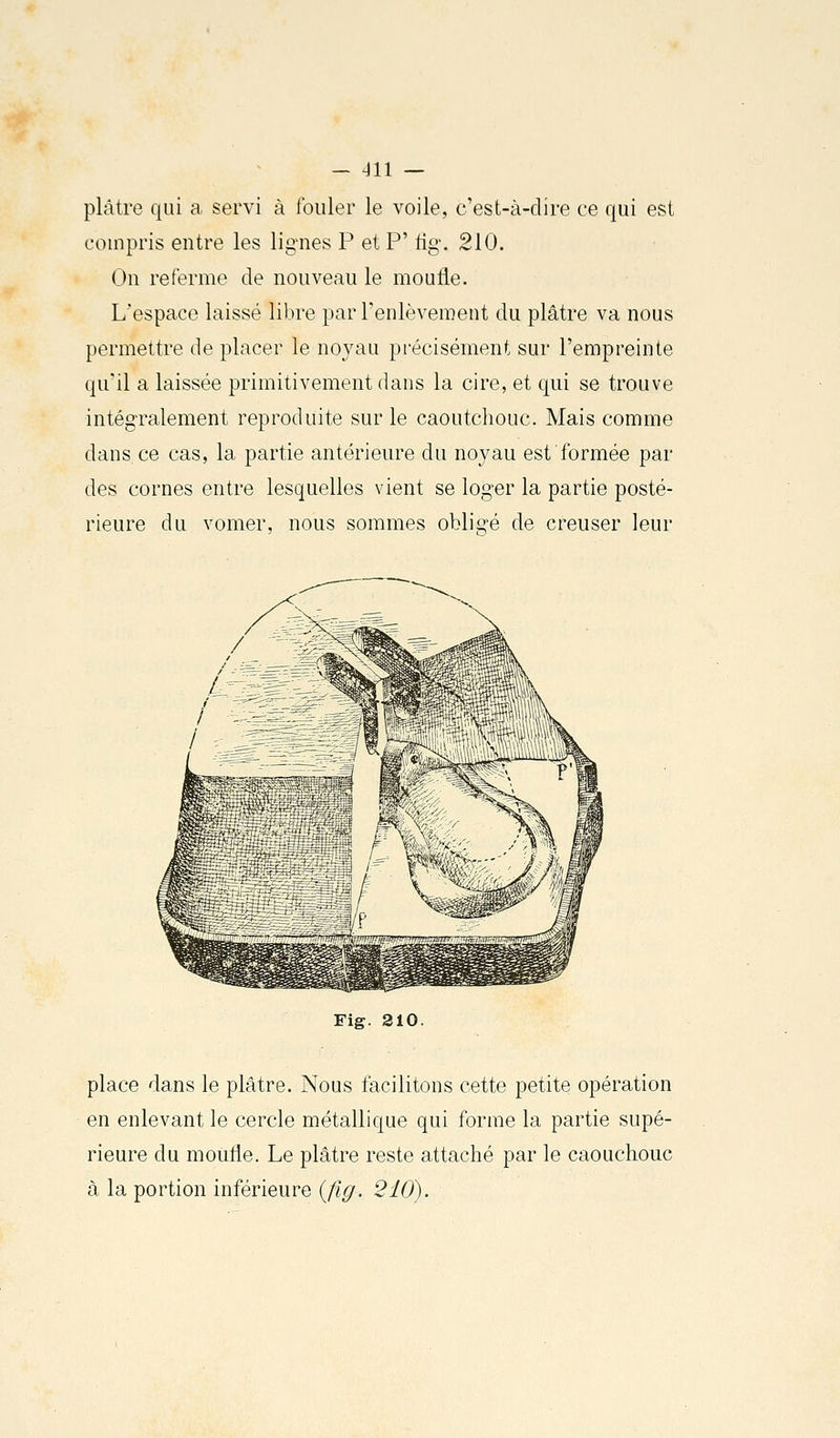 plâtre qui a servi à fouler le voile, c'est-à-dire ce qui est compris entre les lignes P et P' fig\ 210. On referme de nouveau le moufle. L'espace laissé libre par l'enlèvement du plâtre va nous permettre de placer le noyau précisément sur l'empreinte qu'il a laissée primitivement dans la cire, et qui se trouve intégralement reproduite sur le caoutchouc. Mais comme dans ce cas, la partie antérieure du noyau est formée par des cornes entre lesquelles vient se loger la partie posté- rieure du vomer, nous sommes obligé de creuser leur Fig. 210. place dans le plâtre. Nous facilitons cette petite opération en enlevant le cercle métallique qui forme la partie supé- rieure du moufle. Le plâtre reste attaché par le caouchouc à la portion inférieure (Jig. 210).