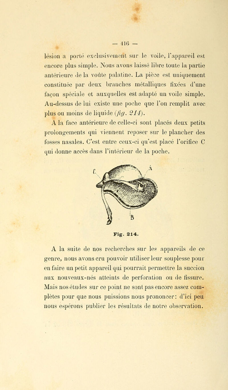 lésion a porté exclusivement sur le voile, Tappareil est encore plus simple. Nous avons laissé libre toute la partie antérieure de la voûte palatine. La pièce est uniquement constituée par deux branches métalliques fixées d'une façon spéciale et auxquelles est adapté un voile simple. Au-dessus de lui existe une poche que l'on remplit avec plus ou moins de liquide {fig. 214). A la face antérieure de celle-ci sont placés deux petits prolongements qui viennent reposer sur le plancher des fosses nasales. C'est entre ceux-ci qu'est placé l'orifice C qui donne accès dans l'intérieur de la poche. Fig. 214. A la suite de nos recherches sur les appareils de ce genre, nous avons cru pouvoir utiliser leur souplesse pour en faire un petit appareil qui pourrait permettre la succion aux nouveaux-nés atteints de perforation ou de fissure. Mais nos études sur ce point ne sont pas encore assez com- plètes pour que nous puissions nous prononcer: d'ici peu nous espérons publier les résultats de notre observation.