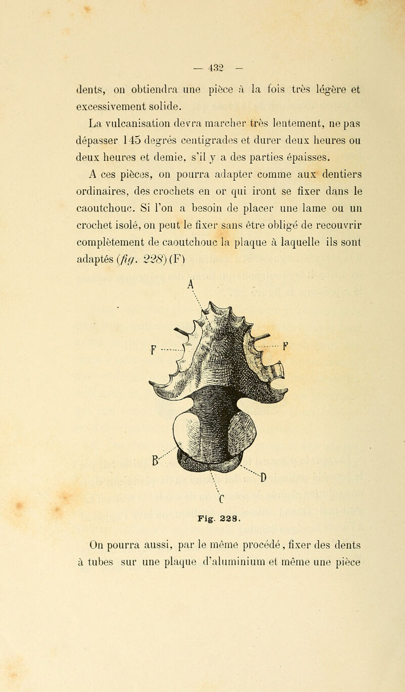 dents, on obtiendra une pièce à la fois très légère et excessivement solide. La vulcanisation devra marcher très lentement, ne pas dépasser 145 degrés centigrades et durer deux heures ou deux heures et demie, s'il y a des parties épaisses. A ces pièces, on pourra adapter comme aux dentiers ordinaires, des crochets en or qui iront se fixer dans le caoutchouc. Si l'on a besoin de placer une lame ou un crochet isolé, on peut le fixer sans être obligé de recouvrir complètement de caoutchouc la plaque à laquelle ils sont adaptés (^^. 228) (F) Fig. 228. On pourra aussi, par le même procédé, fixer des dents à tubes sur une plaque d'aluminium et même une pièce
