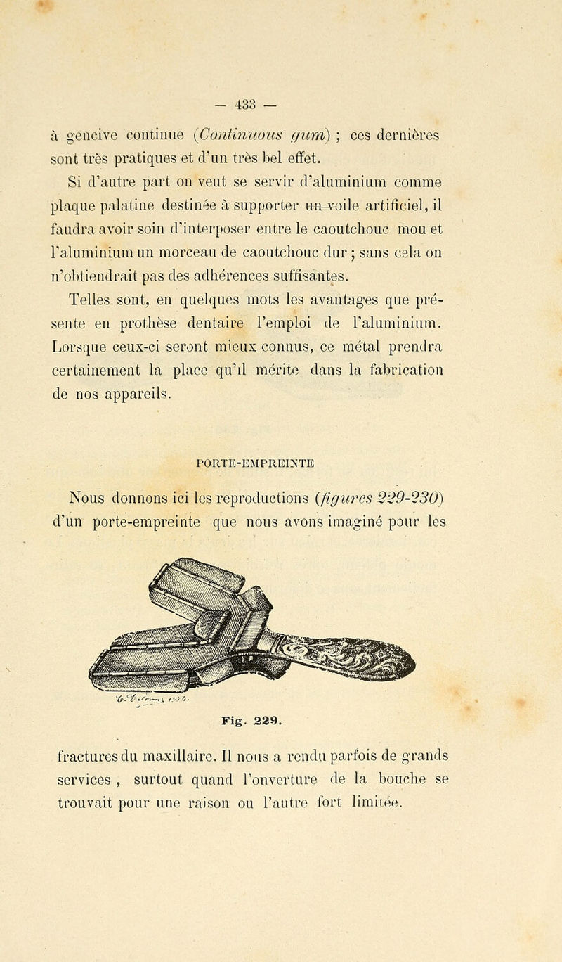 à gencive continue {Continuons gum) ; ces dernières sont très pratiques et d'un très bel effet. Si d'autre part on veut se servir d'aluminium comme plaque palatine destinée à supporter nu-^oile artificiel, il faudra avoir soin d'interposer entre le caoutchouc mou et Taluminium un morceau de caoutchouc dur ; sans cela on n'obtiendrait pas des adhérences suffisantes. Telles sont, en quelques mots les avantages que pré- sente en prothèse dentaire l'emploi de l'aluminium. Lorsque ceux-ci seront mieux connus, ce métal prendra certainement la place qu'd mérite dans la fabrication de nos appareils. PORTE-EMPREINTE Nous donnons ici les reproductions {figures 229-230) d'un porte-empreinte que nous avons imaginé pour les fractures du maxillaire. Il nous a rendu parfois de grands services , surtout quand l'ouverture de la bouche se trouvait pour une raison ou l'autre fort limitée.