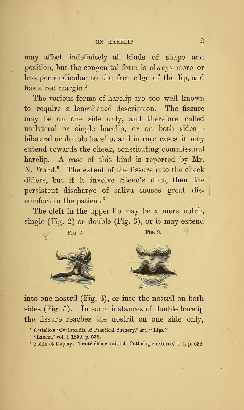 may affect indefinitely all kinds of shape and position, but the congenital form is always more or less perpendicular to the free edge of the lip, and has a red margin.1 The various forms of harelip are too well known to require a lengthened description. The fissure may be on one side only, and therefore called unilateral or single harelip, or on both sides— bilateral or double harelip, and in rare cases it may extend towards the cheek, constituting commissural harelip. A case of this kind is reported by Mr. N. Ward.3 The extent of the fissure into the cheek differs, but if it involve Steno's duct, then the persistent discharge of saliva causes great dis- comfort to the patient.3 The cleft in the upper lip may be a mere notch, single (Fig. 2) or double (Fig. 3), or it may extend Fig. 2. Fig. 3. into one nostril (Fig. 4), or into the nostril on both sides (Fig. 5). In some instances of double harelip the fissure reaches the nostril on one side only, 1 Costello's ' Cyclopsedia of Practical Surgery,' art.  Lips. 2 'Lancet,' vol. i, 1859, p. 536. 3 Follin et Duplay,' Traite elementaire de Pathologie externe,' t. 4, p. 639.