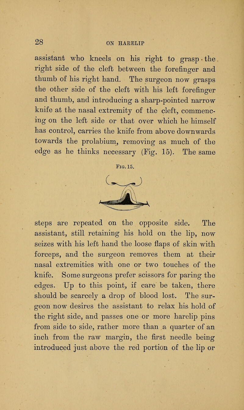 assistant who kneels on his right to grasp • the. right side of the cleft between the forefinger and thumb of his right hand. The surgeon now grasps the other side of the cleft with his left forefinger and thumb, and introducing a sharp-pointed narrow knife at the nasal extremity of the cleft, commenc- ing on the left side or that over which he himself has control, carries the knife from above downwards towards the prolabium, removing as much of the edge as he thinks necessary (Fig. 15). The same Fig. 15. steps are repeated on the opposite side. The assistant, still retaining his hold on the lip, now seizes with his left hand the loose flaps of skin with forceps, and the surgeon removes them at their nasal extremities with one or two touches of the knife. Some surgeons prefer scissors for paring the edges. Up to this point, if care be taken, there should be scarcely a drop of blood lost. The sur- geon now desires the assistant to relax his hold of the right side, and passes one or more harelip pins from side to side, rather more than a quarter of an inch from the raw margin, the first needle being introduced just above the red portion of the lip or