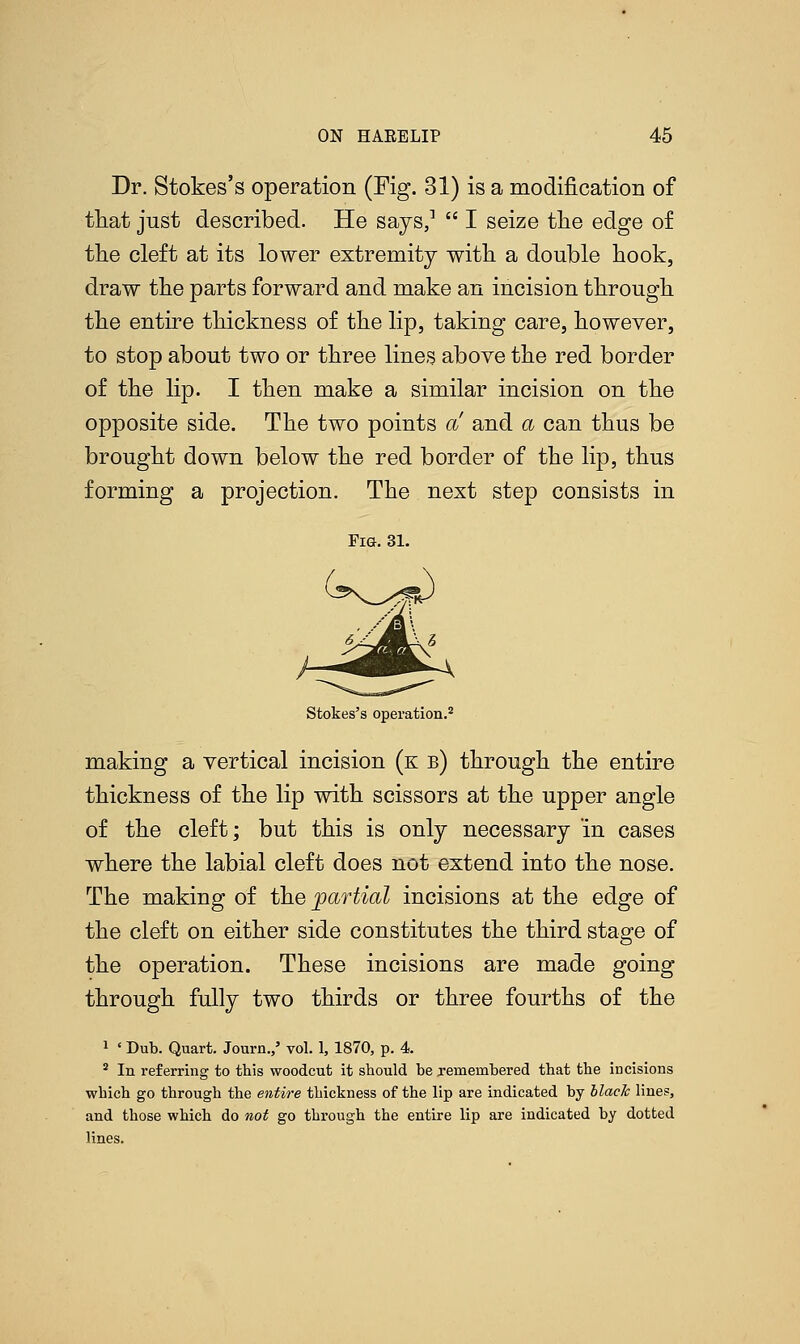 Dr. Stokes's operation (Fig. 31) is a modification of that just described. He says,1  I seize the edge of the cleft at its lower extremity with a double hook, draw the parts forward and make an incision through the entire thickness of the lip, taking care, however, to stop about two or three lines above the red border of the lip. I then make a similar incision on the opposite side. The two points a and a can thus be brought down below the red border of the lip, thus forming a projection. The next step consists in Fig. 31. Stokes's operation.2 making a vertical incision (k b) through the entire thickness of the lip with scissors at the upper angle of the cleft; but this is only necessary in cases where the labial cleft does not extend into the nose. The making of the partial incisions at the edge of the cleft on either side constitutes the third stage of the operation. These incisions are made going through fully two thirds or three fourths of the 1 < Dub. Quart. Journ.,' vol. 1, 1870, p. 4. 2 In referring to this woodcut it should be remembered that the incisions wbich go through the entire thickness of the lip are indicated by black lines, and those which do not go through the entire lip are indicated by dotted lines.