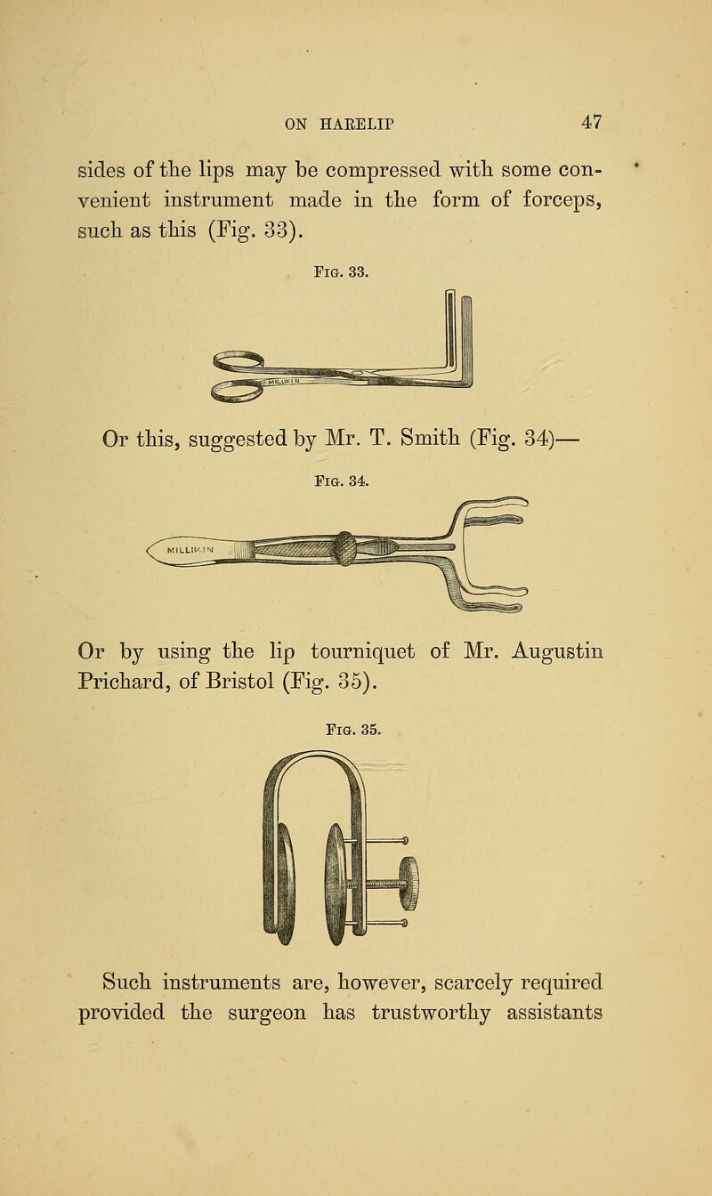 sides of the lips may be compressed with, some con- venient instrument made in the form of forceps, such as this (Fig. 33). Fig. 33. Or this, suggested by Mr. T. Smith (Fig. 34)- FiG. 34. Or by using the lip tourniquet of Mr. Augustin Prichard, of Bristol (Fig. 35). Fig. 35. Such instruments are, however, scarcely required provided the surgeon has trustworthy assistants