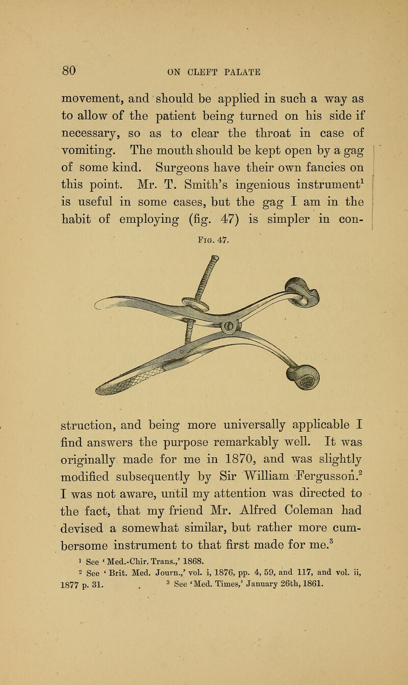movement, and should be applied in such a way as to allow of the patient being turned on his side if necessary, so as to clear the throat in case of vomiting. The mouth should be kept open by a gag of some kind. Surgeons have their own fancies on this point. Mr. T. Smith's ingenious instrument1 is useful in some cases, but the gag I am in the habit of employing (fig. 47) is simpler in con- Fig. 47. struction, and being more universally applicable I find answers the purpose remarkably well. It was originally made for me in 1870, and was slightly modified subsequently by Sir William Fergusson.2 I was not aware, until my attention was directed to the fact, that my friend Mr. Alfred Coleman had devised a somewhat similar, but rather more cum- bersome instrument to that first made for me.3 1 See ' Med.-Chir. Trans.,' 1868. 2 See ' Brit. Med. Journ.,' vol. i, 1876, pp. 4, 59, and 117, and vol. ii, 1877 p. 31. . 3 See 'Med. Times,' January 26th, 1861.