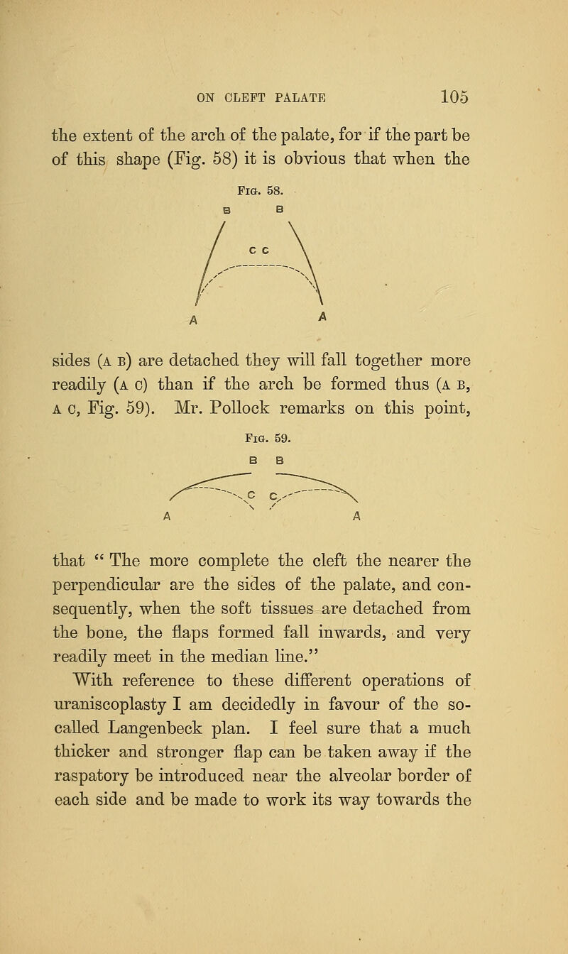 the extent of the arch of the palate, for if the part be of this shape (Fig. 58) it is obvious that when the Pia. 58. B B sides (a b) are detached they will fall together more readily (a c) than if the arch be formed thus (a b, a c, Fig. 59). Mr. Pollock remarks on this point, that The more complete the cleft the nearer the perpendicular are the sides of the palate, and con- sequently, when the soft tissues are detached from the bone, the flaps formed fall inwards, and very readily meet in the median line. With reference to these different operations of uraniscoplasty I am decidedly in favour of the so- called Langenbeck plan. I feel sure that a much thicker and stronger flap can be taken away if the raspatory be introduced near the alveolar border of each side and be made to work its way towards the