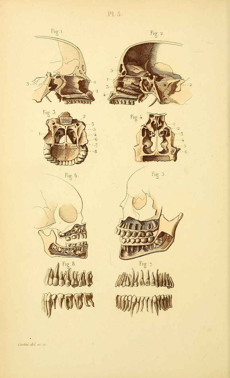 3 - -^-^' l'orlné del- cl se