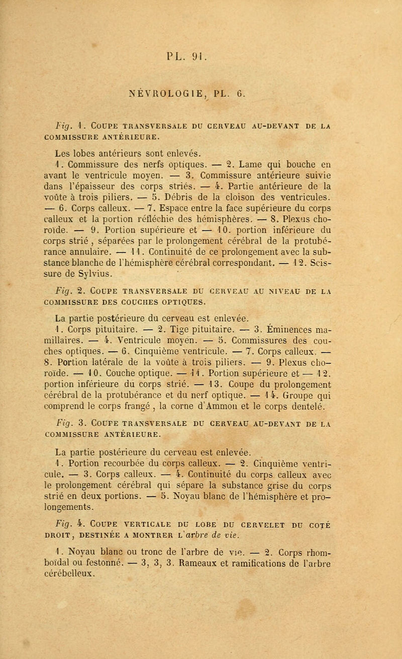 NEVROLOGIE, PL. 6. Fig. 1. Coupe transversale du cerveau au-devant de la COMMISSURE ANTÉRIEURE. Les lobes antérieurs sont enlevés. 1. Commissure des nerfs optiques. — 2. Lame qui bouche en avant le ventricule moyen. — 3. Commissure antérieure suivie dans l'épaisseur des corps striés. — 4. Partie antérieure de la voûte à trois piliers. — 5. Débris de la cloison des ventricules. — 6. Corps calleux. — 7. Espace entre la face supérieure du corps calleux et la portion réfléchie des hémisphères. — 8. Plexus cho- roïde. — 9. Portion supérieure et — 10. portion inférieure du corps strié , séparées par le prolongement cérébral de la protubé- rance annulaire. — 11. Continuité de ce prolongement avec la sub- stance blanche de l'hémisphère cérébral correspondant. — 12. Scis- sure de Sylvius. Fig. 2. Coupe transversale du cerveau au niveau de la COMMISSURE DES COUCHES OPTIQUES. La partie postérieure du cerveau est enlevée. 1. Corps pituitaire. — 2. Tige pituitaire. — 3. Éminences ma- millaires. — 4. Ventricule moyen. — 5. Commissures des cou- ches optiques. — 6. Cinquième ventricule. — 7. Corps calleux. — 8. Portion latérale de la voûte à trois piliers. — 9. Plexus cho- roïde. — 10. Couche optique. — H. Portion supérieure et— 12. portion inférieure du corps strié. — 13. Coupe du prolongement cérébral de la protubérance et du nerf optique. — 1 4. Groupe qui comprend le corps frangé , la corne d'Ammou et le corps dentelé. Fig. 3. Coupe transversale du cerveau au-devant de la COMMISSURE ANTÉRIEURE. La partie postérieure du cerveau est enlevée. 1. Portion recourbée du corps calleux. — 2. Cinquième ventri- cule. — 3. Corps calleux. — 4. Continuité du corps calleux avec le prolongement cérébral qui sépare la substance grise du corps strié en deux portions. — o. Noyau blanc de l'hémisphère et pro- longements. Fig. 4. Coupe verticale du lobe du cervelet du coté DROIT, destinée A MONTRER L arbre de vie. 1. Noyau blanc ou tronc de l'arbre de vie. — 2. Corps rhom- boïdal ou festonné. — 3, 3, 3. Rameaux et ramifications de l'arbre cérébelleux.