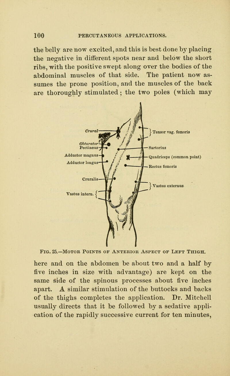 the belly are now excited, and this is best done by placing the negative in different spots near and below the short ribs, with the positive swept along over the bodies of the abdominal muscles of that side. The patient now as- sumes the prone position, and the muscles of the back are thoroughly stimulated; the two poles (which may Crural Adductor magnus Adductor longus Vastus intern. | Tensor vag. femoria Sartorius Quadriceps (common point) Rectus femoris 1 Vastus externus Fig. 25.—Motor Points of Anterior Aspect of Left Thigh. here and on the abdomen be about two and a half by five inches in size with advantage) are kept on the same Side of the spinous processes about five inches apart. A similar stimulation of the buttocks and backs of the thighs completes the application. Dr. Mitchell usually directs that it be followed by a sedative appli- cation of the rapidly successive current for ten minutes,