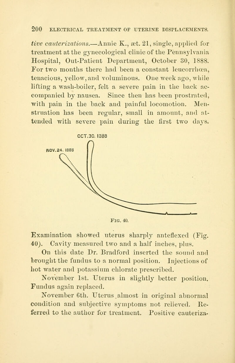tive cauterizations.—Annie K., aet. 21, single, applied for treatment at the gynecological clinic of the Pennsylvania Hospital, Out-Patient Department, October 30, 1888. For two months there had been a constant leucorrhoea, tenacious, yellow, and voluminous. One wreek ago, while lifting a wash-boiler, felt a severe pain in the back ac- companied by nausea. Since then has been prostrated, with pain in the back and painful locomotion. Men- struation has been regular, small in amount, and at- tended with severe pain during the first two days. OCT.30. 1388 NOV.24. 1888 w \\ Fig. 40. Examination showed uterus sharpty anteflexed (Fig. 40). Cavity measured two and a half inches, pins. On this date Dr. Bradford inserted the sound and brought the fundus to a normal position. Injections of hot water and potassium chlorate prescribed. November 1st. Uterus in slightly better position. Fundus again replaced. November 6th. Uterus.almost in original abnormal condition and subjective symptoms not relieved. Re- ferred to the author for treatment. Positive cauteriza-