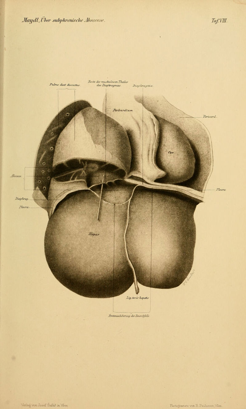 Iteste des rrmshulösen. Theiles Fubtw dext dissectus. des Diaphragmas. Diaphragma. J'eritffrwaUiherzug des ZwerchfeUs. Verlag vtm. Josef Safäf inVfien. HiotDiSravure von R. Paulussen.'WHeii.