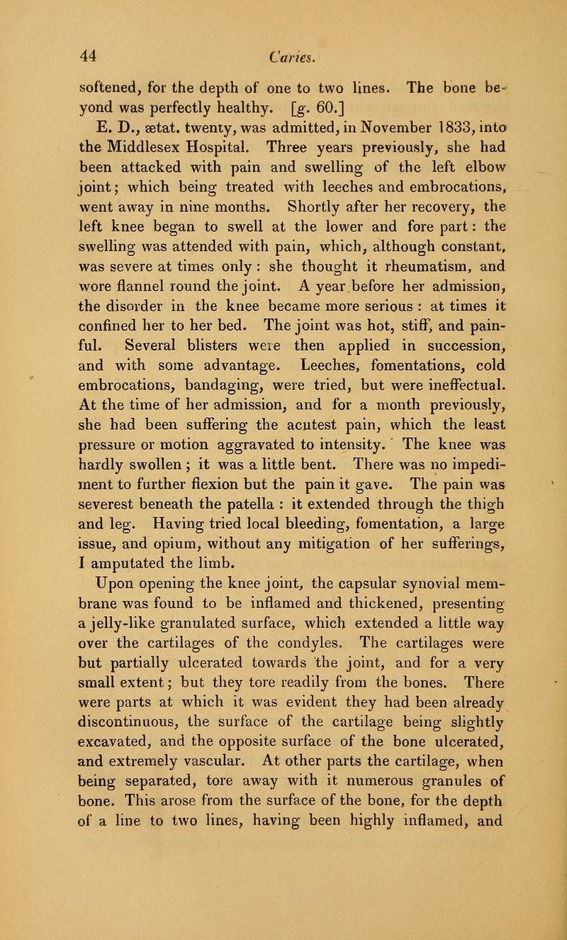 softened, for the depth of one to two lines. The bone be- yond was perfectly healthy, [g. 60.] E. D., aetat. twenty, was admitted, in November 1833, into the Middlesex Hospital. Three years previously, she had been attacked with pain and swelling of the left elbow joint; which being treated with leeches and embrocations, went away in nine months. Shortly after her recovery, the left knee began to swell at the lower and fore part: the swelling was attended with pain, which, although constant, was severe at times only; she thought it rheumatism, and wore flannel round the joint. A year before her admission, the disorder in the knee became more serious : at times it confined her to her bed. The joint was hot, stiff, and pain- ful. Several blisters were then applied in succession, and with some advantage. Leeches, fomentations, cold embrocations, bandaging, were tried, but were ineffectual. At the time of her admission, and for a month previously, she had been suffering the acutest pain, which the least pressure or motion aggravated to intensity. ' The knee was hardly swollen ; it was a little bent. There was no impedi- ment to further flexion but the pain it gave. The pain was severest beneath the patella : it extended through the thigh and leg. Having tried local bleeding, fomentation, a large issue, and opium, without any mitigation of her sufferings, I amputated the limb. Upon opening the knee joint, the capsular synovial mem- brane was found to be inflamed and thickened, presenting a jelly-like granulated surface, which extended a little way over the cartilages of the condyles. The cartilages were but partially ulcerated towards the joint, and for a very small extent; but they tore readily from the bones. There were parts at which it was evident they had been already discontinuous, the surface of the cartilage being slightly excavated, and the opposite surface of the bone ulcerated, and extremely vascular. At other parts the cartilage, when being separated, tore away with it numerous granules of bone. This arose from the surface of the bone, for the depth of a line to two lines, having been highly inflamed, and