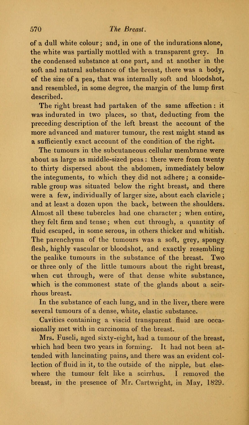 of a dull white colour; and, in one of the indurations alone, the white was partially mottled with a transparent grey. In the condensed substance at one part, and at another in the soft and natural substance of the breast, there was a body, of the size of a pea, that was internally soft and bloodshot, and resembled, in some degree, the margin of the lump first described. The right breast had partaken of the same affection: it was indurated in two places, so that, deducting from the preceding description of the left breast the account of the more advanced and maturer tumour, the rest might stand as a sufficiently exact account of the condition of the right. The tumours in the subcutaneous cellular membrane were about as large as middle-sized peas: there were from twenty to thirty dispersed about the abdomen, immediately below the integuments, to which they did not adhere; a conside- rable group was situated below the right breast, and there were a few, individually of larger size, about each clavicle ; and at least a dozen upon the back, between the shoulders. Almost all these tubercles had one character; when entire, they felt firm and tense; when cut through, a quantity of fluid escaped, in some serous, in others thicker and whitish. The parenchyma of the tumours was a soft, grey, spongy flesh, highly vascular or bloodshot, and exactly resembling the pealike tumours in the substance of the breast. Two or three only of the little tumours about the right breast, when cut through, were of that dense white substance, which is the commonest state of the glands about a scir- rhous breast. In the substance of each lung, and in the liver, there were several tumours of a dense, white, elastic substance. Cavities containing a viscid transparent fluid are occa- sionally met with in carcinoma of the breast. Mrs. Fuseli, aged sixty-eight, had a tumour of the breast, which had been two yeais in forming. It had not been at- tended with lancinating pains, and there was an evident col- lection of fluid in it, to the outside of the nipple, but else- where the tumour felt like a scirrhus. I removed the breast, in the presence of Mr. Cartwright, in May, 1829.
