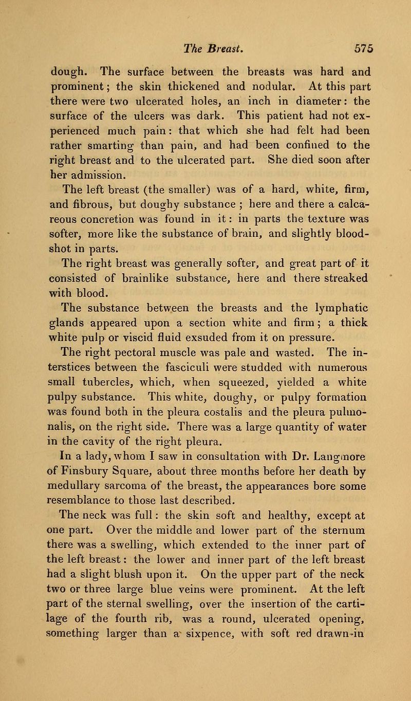 dough. The surface between the breasts was hard and prominent; the skin thickened and nodular. At this part there were two ulcerated holes, an inch in diameter: the surface of the ulcers was dark. This patient had not ex- perienced much pain: that which she had felt had been rather smarting than pain, and had been confined to the right breast and to the ulcerated part. She died soon after her admission. The left breast (the smaller) was of a hard, white, firm, and fibrous, but doughy substance ; here and there a calca- reous concretion was found in it: in parts the texture was softer, more hke the substance of brain, and slightly blood- shot in parts. The right breast was generally softer, and great part of it consisted of brainlike substance, here and there streaked with blood. The substance between the breasts and the lymphatic glands appeared upon a section white and firm; a thick white pulp or viscid fluid exsuded from it on pressure. The right pectoral muscle was pale and wasted. The in- terstices between the fasciculi were studded with numerous small tubercles, which, when squeezed, yielded a white pulpy substance. This white, doughy, or pulpy formation was found both in the pleura costalis and the pleura pulmo- nalis, on the right side. There was a large quantity of water in the cavity of the right pleura. In a lady, whom I saw in consultation with Dr. Langinore of Finsbury Square, about three months before her death by medullary sarcoma of the breast, the appearances bore some resemblance to those last described. The neck was full: the skin soft and healthy, except at one part. Over the middle and lower part of the sternum there was a swelling, which extended to the inner part of the left breast: the lower and inner part of the left breast had a slight blush upon it. On the upper part of the neck two or three large blue veins were prominent. At the left part of the sternal swelling, over the insertion of the carti- lage of the fourth rib, was a round, ulcerated opening, something larger than a^ sixpence, with soft red drawn-in