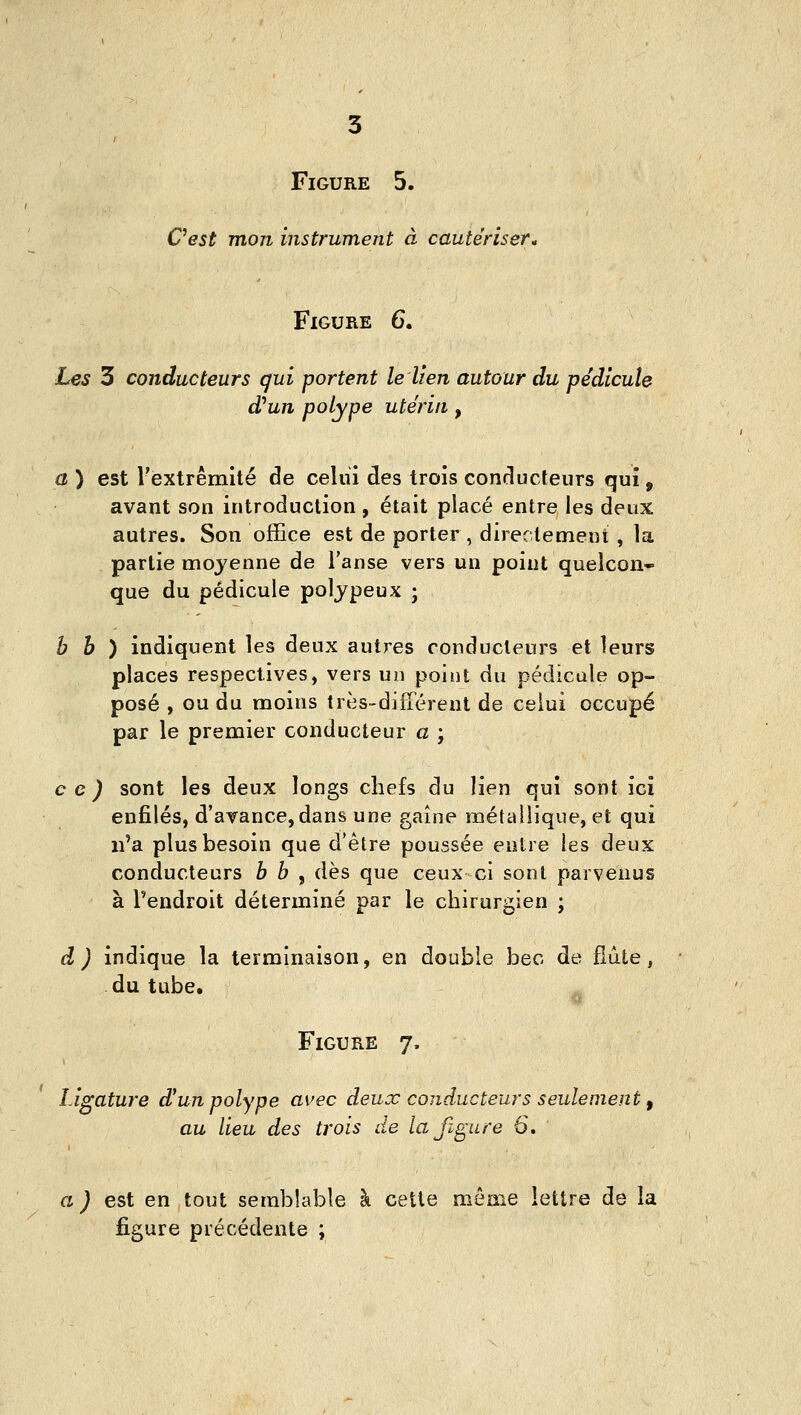 3 Figure 5. Cest mon instrument à cautériser» Figure 6, Les 3 conducteurs qui portent le lien autour du pédicule d'un polype utérin, a ) est l'extrémité de celui des trois conducteurs qui, avant son introduction , était placé entre les deux autres. Son office est de porter, directement , la partie moyenne de l'anse vers un point quelcon- que du pédicule poljpeux ; h h ) indiquent les deux autres conducteurs et leurs places respectives, vers un point du pédicule op- posé , ou du moins très-difFérent de celui occupé par le premier conducteur a ; ce) sont les deux longs chefs du lien qui sont ici enfilés, d'avance,dans une gaine métallique, et qui n'a plus besoin que d'être poussée entre les deux conducteurs h h , dès que ceux ci sont parvenus à l'endroit déterminé par le chirurgien ; â) indique la terminaison, en double bec de fldie, du tube. Figure 7, Ligature d^un polype avec deux conducteurs seulement ^ au lieu des trois de la figure 6. a) est en tout semblable à cette môme lettre de la figure précédente ;