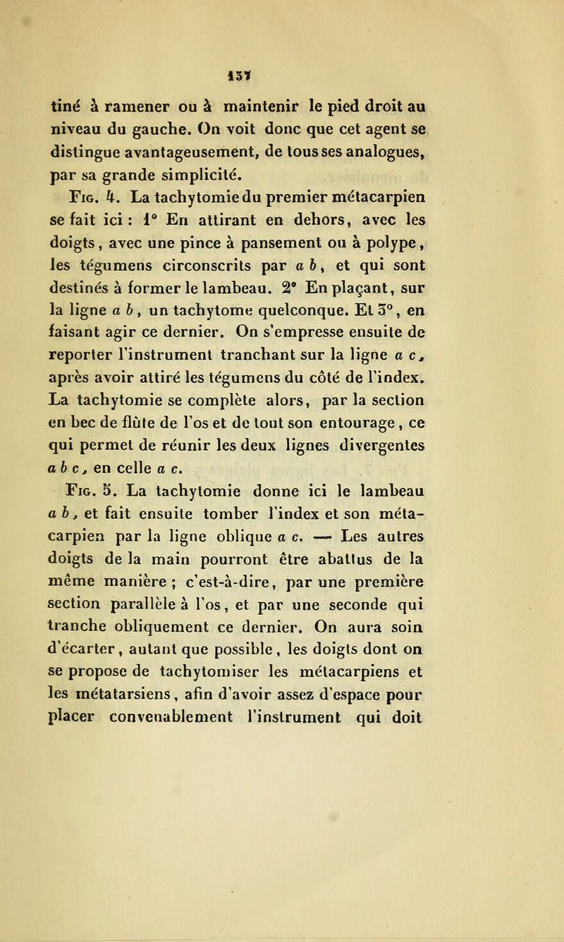 13Ï tiné à ramener ou à maintenir le pied droit au niveau du gauche. On voit donc que cet agent se distingue avantageusement, de tous ses analogues, par sa grande simplicité. FiG. k. La tachytomiedu premier métacarpien se fait ici: 1 En attirant en dehors, avec les doigts, avec une pince à pansement ou à polype, les tégumens circonscrits par a 6, et qui sont destinés à former le lambeau. 2* En plaçant, sur la ligne a 6, un tachytome quelconque. Et 3°, en faisant agir ce dernier. On s'empresse ensuite de reporter l'instrument tranchant sur la ligne a c, après avoir attiré les tégumens du côté de l'index. La tachytomie se complète alors, par la section en bec de flûte de l'os et de tout son entourage, ce qui permet de réunir les deux lignes divergentes abc, en celle a c. FiG. 5. La tachytomie donne ici le lambeau ab j ei fait ensuite tomber l'index et son méta- carpien par la ligne oblique a c. —^ Les autres doigts de la main pourront être abattus de la même manière; c'est-à-dire, par une première section parallèle à l'os, et par une seconde qui tranche obliquement ce dernier. On aura soin d'écarter, autant que possible, les doigts dont on se propose de tachytomiser les métacarpiens et les métatarsiens, afm d'avoir assez d'espace pour placer convenablement l'instrument qui doit