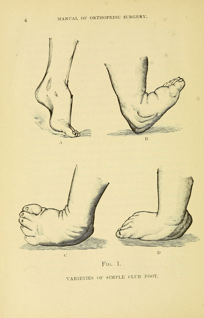 Fig. 1. VARIETIES OF SIMPLE CLUB TOOT.