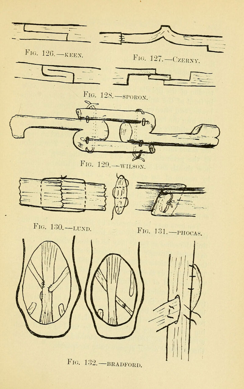 Fig. 12G.—keex. Fjg. 127.—Czerny. -r^ Fig. 128.—sporon. Fig. 130.—luxd. Fig. 131.—phocas. Fig. 132.—BRADFORD.