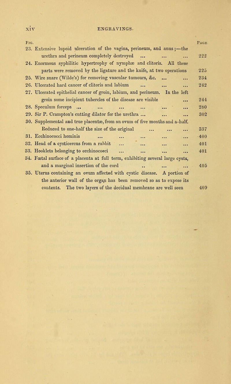 Fig. 23. Extensive lupoid ulceration of the vagina, perineum, and anus;—the urethra and perineum completely destroyed 24. Enormous syphilitic hypertrophy of nymphfe and clitoris. All these parts were removed by the ligatm'e and the knife, at two operations 25. Wire snare (Wilde's) for removing vascular tumom'S, &c. 26. Ulcerated hard cancer of clitoris and labium 27. Ulcerated epithelial cancer of groin, labium, and perineum. In the left groin some incipient tubercles of the disease are visible 28. Speculum forceps ... 29. Sir P. Cramp ton's cutting dilator for the urethra ... 30. Supplemental and true placentse, from an ovum of five months and a-half. Reduced to one-half the size of the original 31. Ecchinococci hominis 32. Head of a cysticercus from a rabbit 33. Hooklets belonging to ecchinococci 34. Foetal surface of a placenta at full term, exhibiting several large cysts, and a marginal insertion of the cord 35. Uterus containing an ovum affected with cystic disease. A portion of the anterior wall of the orga,n has been removed so as to expose its contents. The two layers of the decidual membrane are well seen 222 225 234 242 244 280 302 337 400 401 401 405 409