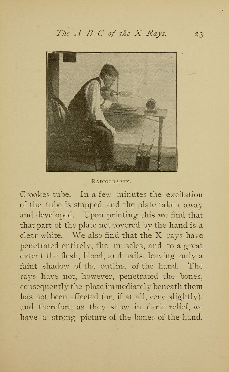 Radiography. Crookes tube. In a few minutes the excitation of the tube is stopped and the plate taken away and developed. Upon printing this we find that that part of the plate not covered by the hand is a clear white. We also find that the X rays have penetrated entirely, the muscles, and to a great extent the flesh, blood, and nails, leaving only a faint shadow of the outline of the hand. The rays have not, however, penetrated the bones, consequently the plate immediately beneath them has not been affected (or, if at all, very slightly), and therefore, as they show in dark relief, we have a strong picture of the bones of the hand.