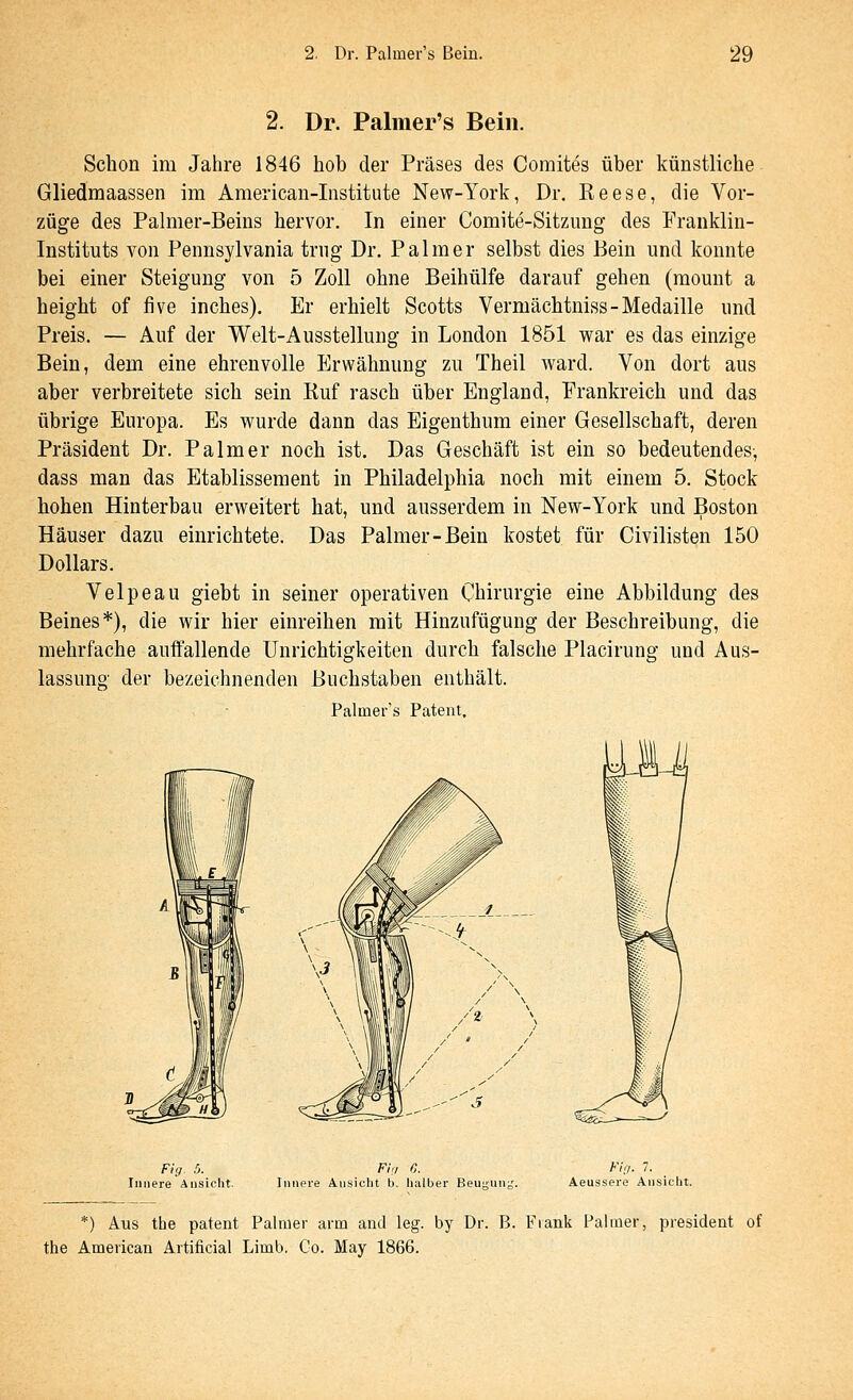 2. Dr. Palmer's Bein. Schon im Jahre 1846 hob der Präses des Comites über künstliche Gliedmaassen im American-Institute New-York, Dr. Keese, die Vor- züge des Palmer-Beins hervor. In einer Comite-Sitzimg des Franklin- Instituts A'on Pennsylvania trng Dr. Palm er selbst dies Bein und konnte bei einer Steigung von 5 Zoll ohne Beihülfe darauf gehen (raount a height of five inches). Er erhielt Scotts Vermächtniss-Medaille und Preis. — Auf der Welt-Ausstellung in London 1851 war es das einzige Bein, dem eine ehrenvolle Erwähnung zu Theil ward. Von dort aus aber verbreitete sich sein Ruf rasch über England, Frankreich und das übrige Europa. Es wurde dann das Eigenthum einer Gesellschaft, deren Präsident Dr. Palm er noch ist. Das Geschäft ist ein so bedeutendes, dass man das Etablissement in Philadelphia noch mit einem 5, Stock hohen Hinterbau erweitert hat, und ausserdem in New-York und Boston Häuser dazu einrichtete. Das Palmer-Bein kostet für Civilisten 150 Dollars. Velpeau giebt in seiner operativen Chirurgie eine Abbildung des Beines*), die wir hier einreihen mit Hinzufügung der Beschreibung, die mehrfache auffallende Unrichtigkeiten durch falsche Placirung und Aus- lassung der bezeichnenden Buchstaben enthält. Palmer's Patent, Fig^ 5. Fh:, ß. Innere Ansicht. Innore Ansicht h. halber Beuiiun^'. Fig. 7. Aeussere Ansicht. *) Aus the patent Palnier arm and leg. by Dr. B. Frank Paimer, president of the American Artificial Limb. Co. May 1866.