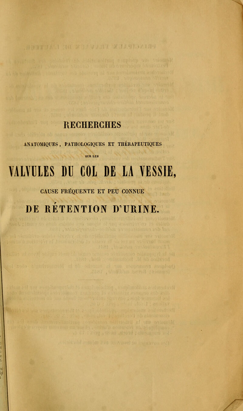 ANATOMIQUES, PATHOLOGIQUES ET THERAPEUTIQUES VALVULES DU COL DE LA VESSIE, CAUSE FRÉQUENTE ET PEU CONNUE DE RÉTENTION DURINE.