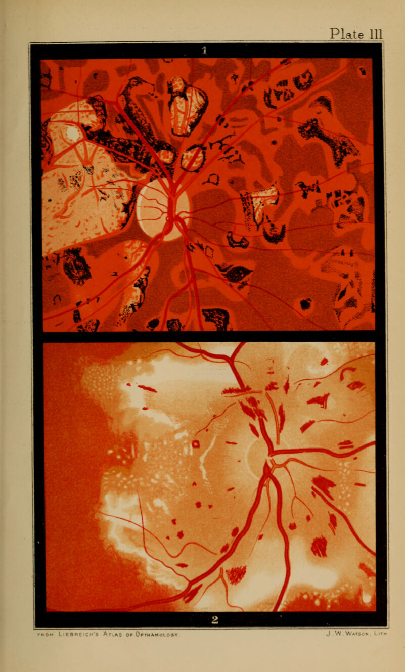 a: Op OprMJk • i • .1 \V Wai •