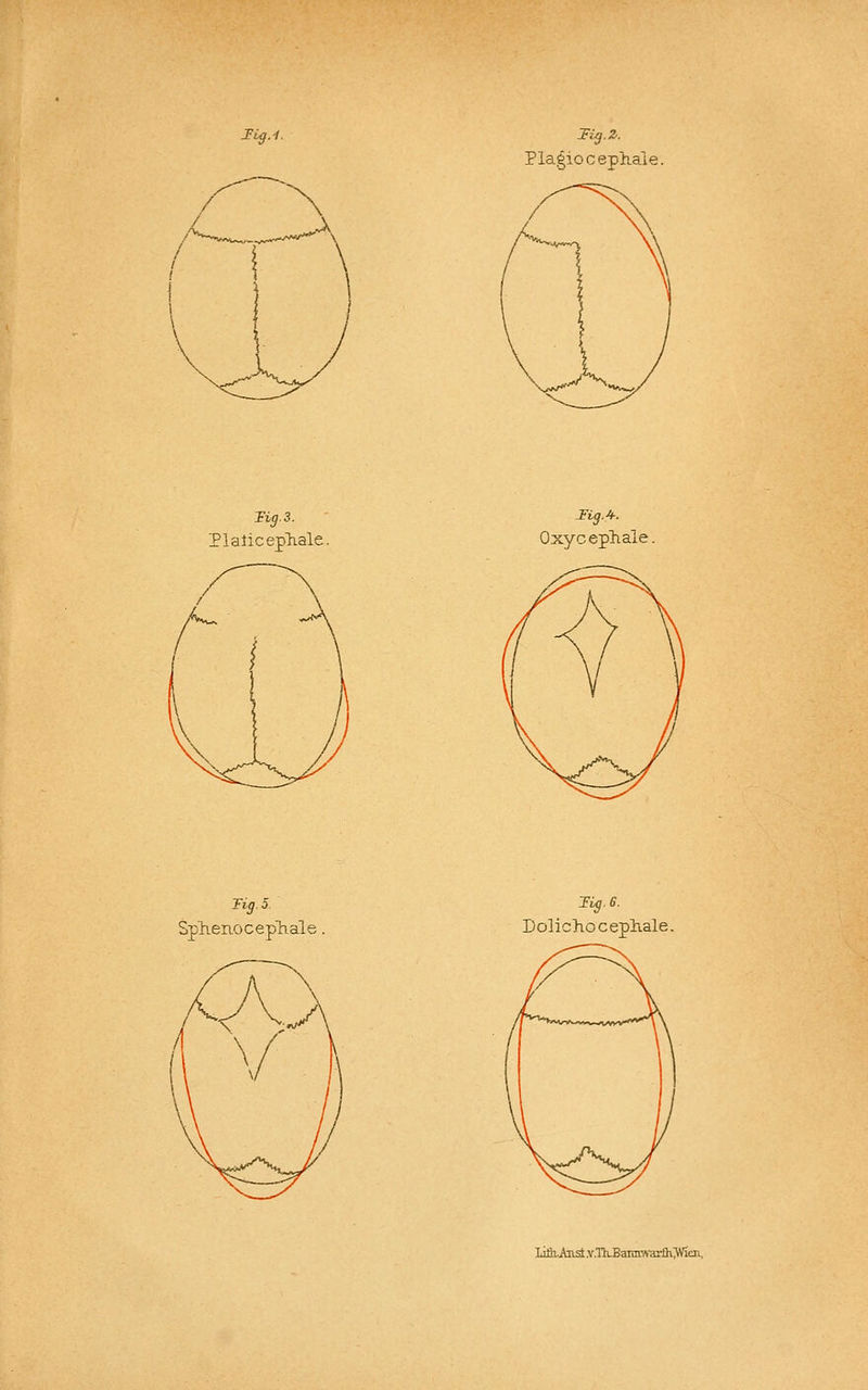Tig.-!. TUj.Z. Plagioc ephale. Plalicepliale. Oxycepliale. %.5 Splienoceplaale DolichGcepliale. Lüh.Aast.v.'nuBaiiim-arfh^Vien..