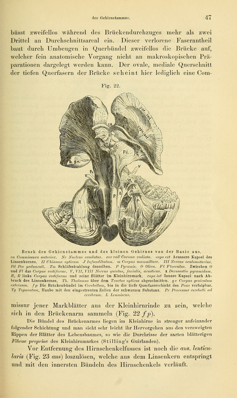 büsst zweifellos während des Brückendurchzuges mehr als zwei Drittel an Durchschnittsareal ein. Dieser verlorene Faserantheil baut durch Umbeugen in Querbündel zweifellos die Brücke auf, welcher fein anatomische Vorgang nicht an makroskopischen Prä- parationen dargelegt werden kann. Der ovale, mediale Querschnitt der tiefen Querfasern der Brücke scheint hier lediglich eine Com- Fig. 22. Bruch des Gehirn Stammes und des kleinen Gehirnes von der Basis aus. ca Commissura anterior. Nc Nuclcus cauäatus. cor rad Corona radiata. caps ext Aeussere Kapsel des Linsenkernes. II CJüasma optinim J Infundihulum. m Corpus maminillare. III Nervus ociilomotorius'. Fd Pes peduncnli. Tm Schläfestrahlung desselhen. P Pyramis. 0 Oliva. Fl Floccidus. Zwischen 0 und Fl das Corpus restiforme. V, VII, VIII Nervus quintus, facialis, acusticus. X Decussatio pyramidum. R, R links Corpus resfiforme und seine Blätter im Kleinhirnmark, caps int Innere Kapsel nach Ah- hruch de.s Linsenkernes. Tli. Thalamus über dem Tractus ojjticiis abgeschnitten, gc Corpus geniculum exlernum. fp Die Brückenbündel im Cerehellum, bis in die tiefe Querfaserschicht des Pons vcrfolgbar. Tg Tegmentum, Haube mit den eingestreuten Zellen der schwarzen Substanz. Pr Processus cerehelli ad cerebrum. L Lemniscus. missur jener Markblätter aus der Kleinhirnrinde zu sein, welche sich in den Brückenarm sammeln (Fig. 22 /p). Die Bündel des Brückenarmes liegen im Kleinhirne in strenger aufeinander folgender Schichtung nnd man sieht sehr leicht ihr Hervorgehen aus den verzweigten Rippen der Blätter des Lebensbaumes, so wie die Durchrisse der zarten blätterigen Fibrae propriae des Kleinhirnmarkes (Stilling's Guirlanden). Vor Entfernung des Hirnschenkelfusses ist noch die ans. lenticu- laris (Fig. 23 ans) loszulösen, welche aus dem Linsenkern entspringt und mit den innersten Bündeln des Hirnschenkels verläuft.