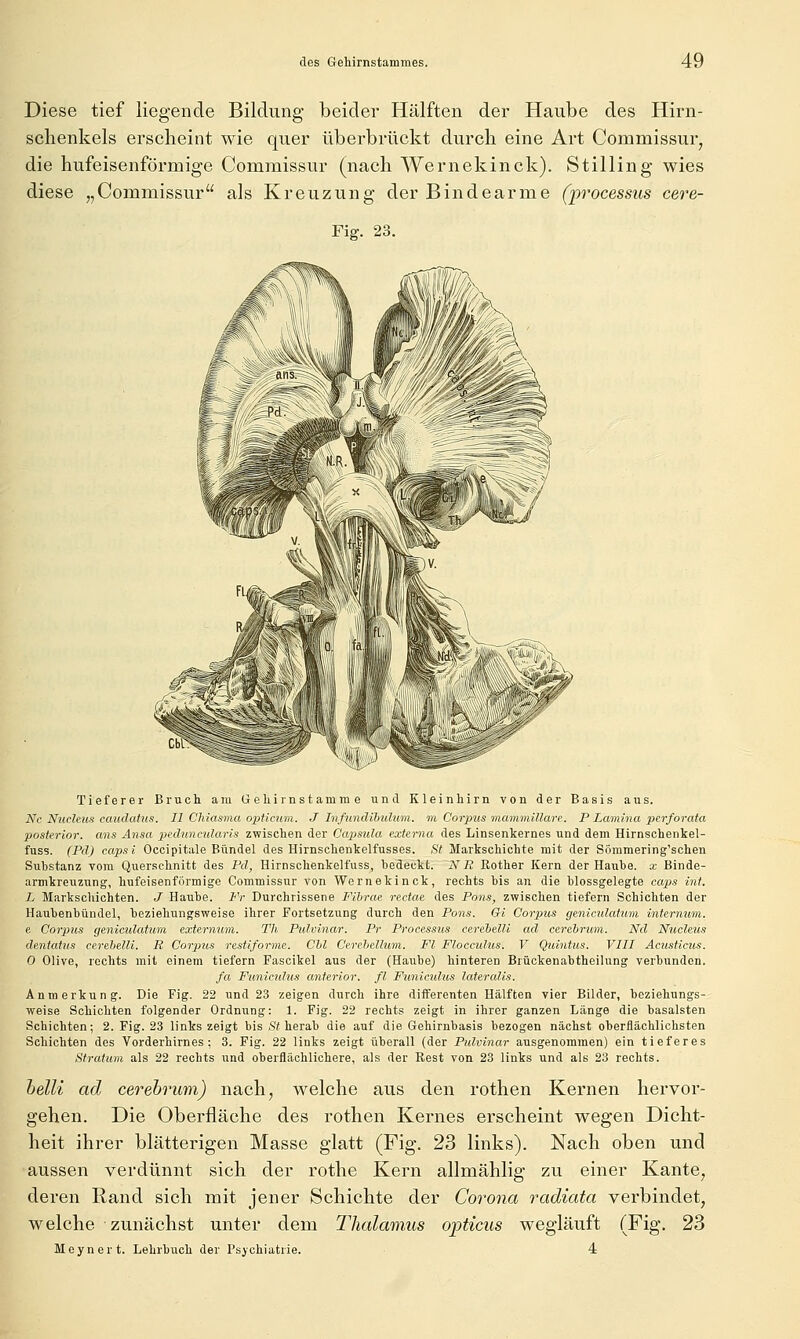 Diese tief liegende Bildung beider Hälften der Haube des Hirn- sehenkels erscheint wie quer überbrückt durch eine Art Commissurj die hufeisenförmige Commissur (nach Wernekinck). Stilling wies diese „Commissur als Kreuzung der Bindearme (p'ocessus cere- Fig. 23. Tieferer Bruch am Oehirnstamme und Kleinhirn von der Basis aus. Nc NucUus eaiidatus. II Chiasma opiicum. J Infundibulum. w. Corpus mammiUare. P Lainina perforata posterior, ans Ansa peduncularis zwischen der Capisula externa des Linsenkernes und dem Hirnsohenkel- fuss. (Pd) capsi Occipitale Bündel des Hirnschenkelfusses. St Markschichte mit der Söramering'schen Substanz vom Querschnitt des Pd, Hirnschenkelt'uss, hedeckt. NR Rother Kern der Hauhe. x Binde- armkrcuzung, hufeisenförmige Commissur von Wernekinck, rechts bis an die blossgelegte caps int. L Markschichten. J Haube. Fr Durchrissene Filirae rectae des Pons, zwischen tiefern Schichten der Haubenbündel, beziehungsweise ihrer Fortsetzung durch den Pons. Qi Corpus geniculatum internum. e Corjyus geniculatum externum. Th Pulvinar. Pr Processus cereielU ad cereirum. Nd Nucleus dentatus cerebelli. R Corpus restiforme. Chi Cerehelhmi. Fl Flocculiis. V Quinttis. VIII Acusticus. 0 Olive, rechts mit einem tiefern Fascikel aus der (Haube) hinteren Brückenabtheilung verbunden. fa Funiculus anterior, fl Funiculus lateralis. Anmerkung. Die Fig. 22 und 23 zeigen durch ihre differenten Hälften vier Bilder, beziehungs- weise Schichten folgender Ordnung: 1. Fig. 22 rechts zeigt in ihrer ganzen Länge die basalsten Schichten; 2. Fig. 23 links zeigt bis .s'# herab die auf die Gehirnbasis bezogen nächst oberflächlichsten Schichten des Vorderhirnes; 3. Fig. 22 links zeigt überall (der Pulvinar ausgenommen) ein tieferes Stratum als 22 rechts und oberflächlichere, als der Rest von 23 links und als 23 rechts. belli ad cerebrum) nach, welche aus den rothen Kernen hervor- gehen. Die Oberfläche des rothen Kernes erscheint wegen Dicht- heit ihrer blätterigen Masse glatt (Fig. 23 links). Nach oben und aussen verdünnt sich der rothe Kern allmählig zu einer Kante, deren Rand sich mit jener Schichte der Corona radiata verbindet, welche zunächst unter dem Thalamus opticus wegläuft (Fig. 23 Meynert. Lehrbuch der Psychiatrie. 4