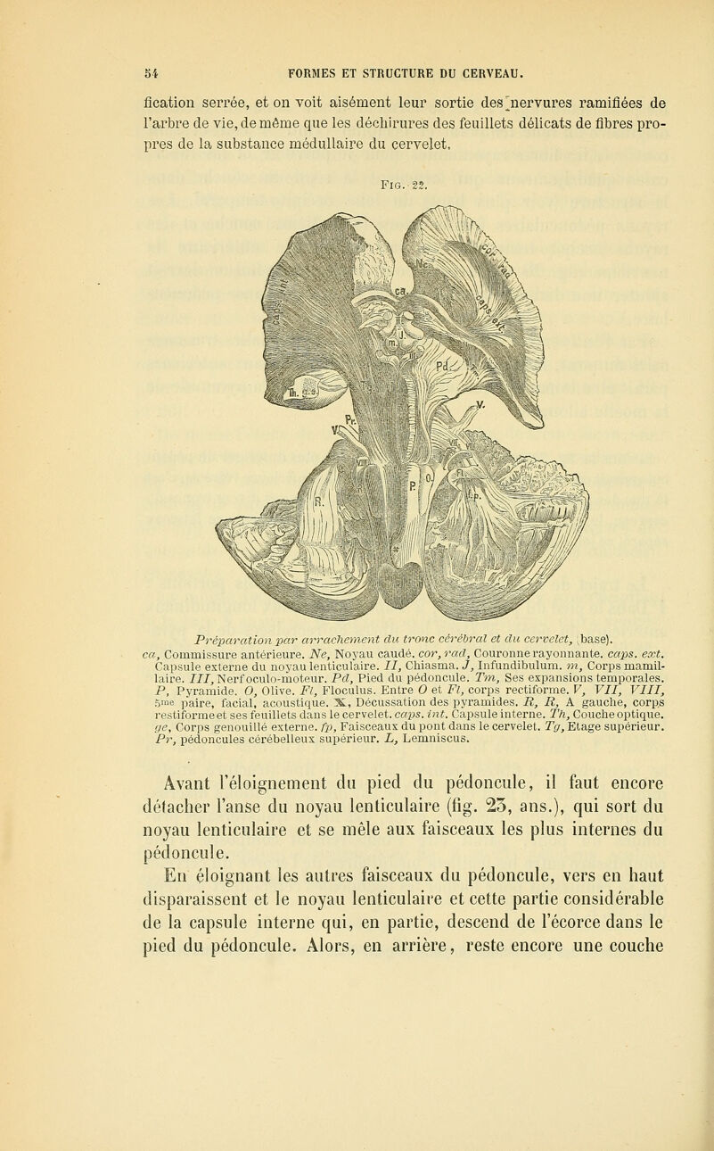 fication serrée, et on voit aisément leur sortie des jiervures ramifiées de l'arbre de vie, de même que les déchirures des feuillets délicats de fibres i^ro- pres de la substance médullaire du cervelet. FiG. 22. Préparation par arrachanent du tronc cérébral et du cervelet, ;base). ca. Commissure antérieure. Ne, Noyau caudé. cor,rad. Couronne rayonnante, caps. ext. Capsule externe du noyau lenticulaire. //, Chiasma. J, Infundibulum. m, Corps mamil- laire. ///, Nerfoculo-moteur. Pd, Pied du pédoncule. Tm, Ses expansions temporales. P, Pyramide. O, Olive. Fl, Floculus. Entre O et Fl, corps rectiforme. V, VII, VIII, 5rae paire, facial, acoustique. X, Décussation des pyramides. R, R, A gauche, corps restifoi'raeet ses feuillets dans le cervelet, caps. int. Capsule interne. Th, Couche optique. ge. Corps genouillé externe, fp. Faisceaux du pont dans le cervelet. Tg, Etage supérieur. Pr, pédoncules cérébelleux supérieur. L, Lemniscus. Avant Téloignement du pied du pédoncule, il faut encore détacher l'anse du noyau lenticulaire (fig. 25, ans.), qui sort du noyau lenticulaire et se mêle aux faisceaux les plus internes du pédoncule. En éloignant les autres faisceaux du pédoncule, vers en haut disparaissent et le noyau lenticulaire et cette partie considérable de la capsule interne qui, en partie, descend de l'écorce dans le pied du pédoncule. Alors, en arrière, reste encore une couche