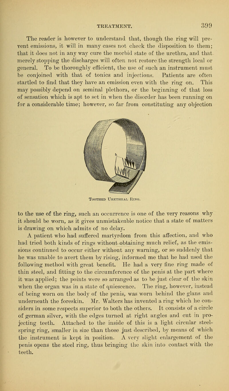 The reader is however to understand that, though the ring will pre- vent emissions^, it will in many cases not check the disposition to them; that it does not in any way cure the morbid state of the urethra, and that merely stopping the discharges will often not restore the strength local or general. To be thoroughly efficient, the use of such an instrument must be conjoined with that of tonics and injections. Patients are often startled to find that they have an emission even with the ring on. This may possibly depend on seminal plethora, or the beginning of that loss of sensation which is apt to set in when the disorder has been running on for a considerable time; however, so far from constituting any objection Toothed Urethral Ring. to the use of the ring, such an occurrence is one of the very reasons why it should be worn, as it gives unmistakeable notice that a state of matters is drawing on which admits of no delay. A patient who had suffered martyrdom from this affection, and who had tried both kinds of rings without obtaining much relief, as the emis- sions continued to occur either without any warning, or so suddenly that he was unable to avert them by rising, informed me that he had used the following method with great benefit. He had a very fine ring made of thin steel, and fitting to the circumference of the penis at the part where it was applied; the points were so arranged as to be just clear of the skin when the organ was in a state of quiescence. The ring, however, instead of being worn on the body of the penis, was worn behind the glans and underneath the foreskin. Mr. Walters has invented a ring which he con- siders in some respects superior to both the others. It consists of a circle of german silver, with the edges turned at right angles and cut in pro- jecting teeth. Attached to the inside of this is a light circular steel- spring ring, smaller in size than those just described, by means of which the instrument is kept in position. A very slight enlargement of the penis opens the steel ring, thus bringing the skin into contact with the teeth.