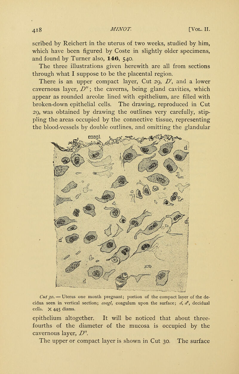 scribed by Reichert in the uterus of two weeks, studied by him, which have been figured by Coste in slightly older specimens, and found by Turner also, 146, 540. The three illustrations given herewith are all from sections through what I suppose to be the placental region. There is an upper compact layer. Cut 29, D\ and a lower cavernous layer, Z?; the caverns, being gland cavities, which appear as rounded areolae lined with epithelium, are filled with broken-down epithelial cells. The drawing, reproduced in Cut 29, was obtained by drawing the outlines very carefully, stip- pling the areas occupied by the connective tissue, representing the blood-vessels by double outlines, and omitting the glandular cnagl. s^^.<^^f^m^- Ctiiso. — Uterus one month pregnant; portion of the compact layer of the de- cidua seen in vertical section; coagl, coagulum upon the surface; d, d', decidual cells. X 445 diams. epithelium altogether. It will be noticed that about three- fourths of the diameter of the mucosa is occupied by the cavernous layer, D. The upper or compact layer is shown in Cut 30. The surface