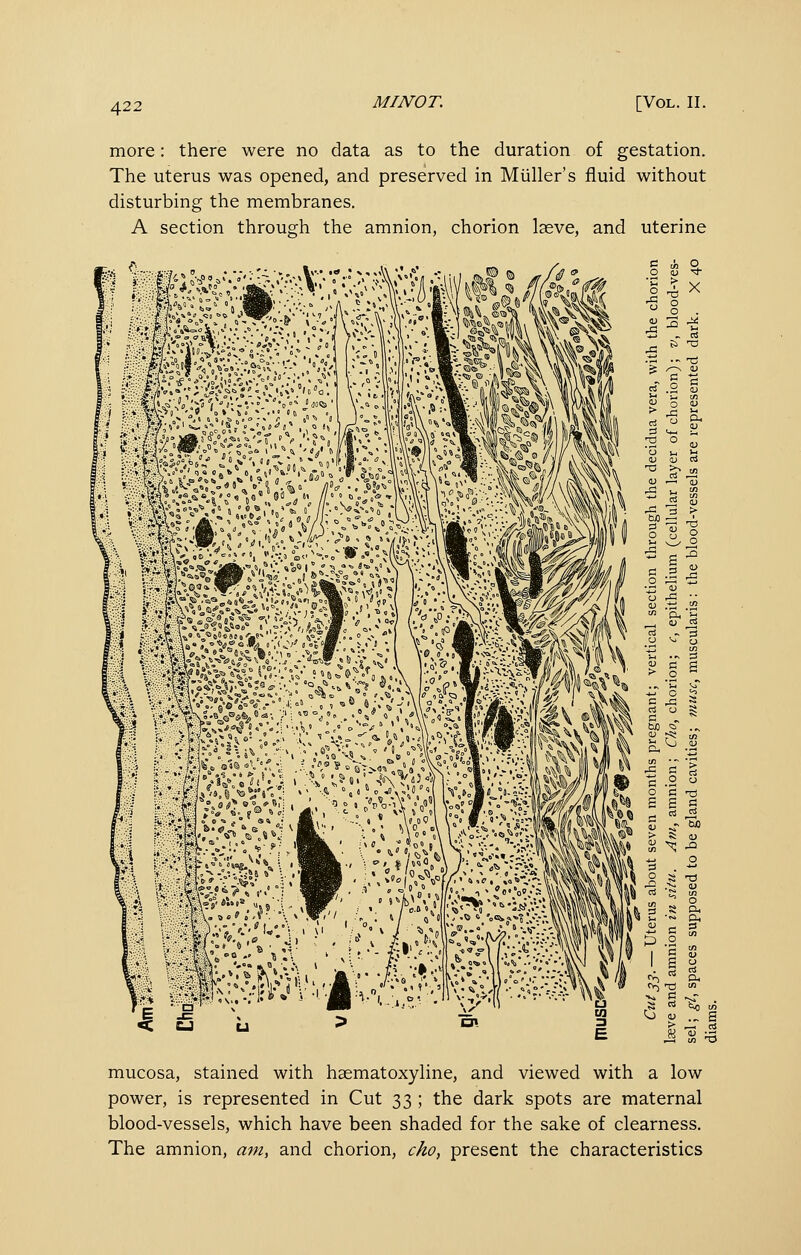 more: there were no data as to the duration of gestation. The uterus was opened, and preserved in Miiller's fluid without disturbing the membranes. A section through the amnion, chorion Iseve, and uterine ■^ w»?;.A;.\;T ';>y/y.V^'•^-v^i• :^i i?*:^^ ;;* B::iM».^^^,:i <c u ^ aj c^ c ^ M -a ..\ <u :^ t/> i-i <o CJ c £ C c _o o o S TJ S E el c3 tin ^ 'Hij '^ J3 g S TJ S .S CLi t^ t^ m mucosa, stained with haematoxyUne, and viewed with a low power, is represented in Cut 33 ; the dark spots are maternal blood-vessels, which have been shaded for the sake of clearness. The amnion, a^n, and chorion, cko, present the characteristics