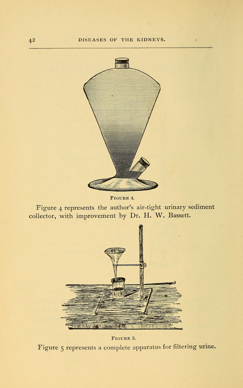 Figure 4. Figure 4 represents the author's air-tight urinary sediment collector, with improvement by Dr. H. W. Bassett. ^HiMffimraiMUMiMmffl^. Figure 5. Figure 5 represents a complete apparatus for filtering urine.