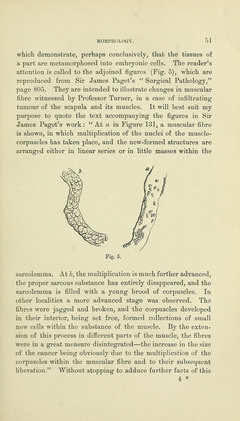 which demonstrate, perhaps conclusively, that the tissues of a part are metamorphosed into embryonic cells. The reader's attention is called to the adjoined figures (Fig. 5), which are reproduced from Sir James Paget's  Surgical Pathology/' page 805. They are intended to illustrate changes in muscular fibre witnessed by Professor Turner, in a case of infiltrating tumour of the scapula and its muscles. It will best suit my purpose to quote the text accompanying the figures in Sir James Paget's work:  At a in Figure 131, a muscular fibre is shown, in which multiplication of the nuclei of the muscle- corpuscles has taken place, and the new-formed structures are arranged either in linear series or in little masses within the Fig. 5. sarcolemma. At h, the multiplication is much further advanced, the proper sarcous substance has entirely disappeared, and the sarcolemma is filled with a young brood of corpuscles. In other localities a more advanced stage was observed. The fibres were jagged and broken, and the corpuscles developed in their interior, being set free, formed collections of small new cells within the substance of the muscle. By the exten- sion of this process in different parts of the muscle, the fibres were in a great measure disintegrated—the increase in the size of the cancer being obviously due to the multiplication of the corpuscles within the muscular fibre and to their subsequent liberation. Without stopping to adduce further facts of this 4 ^