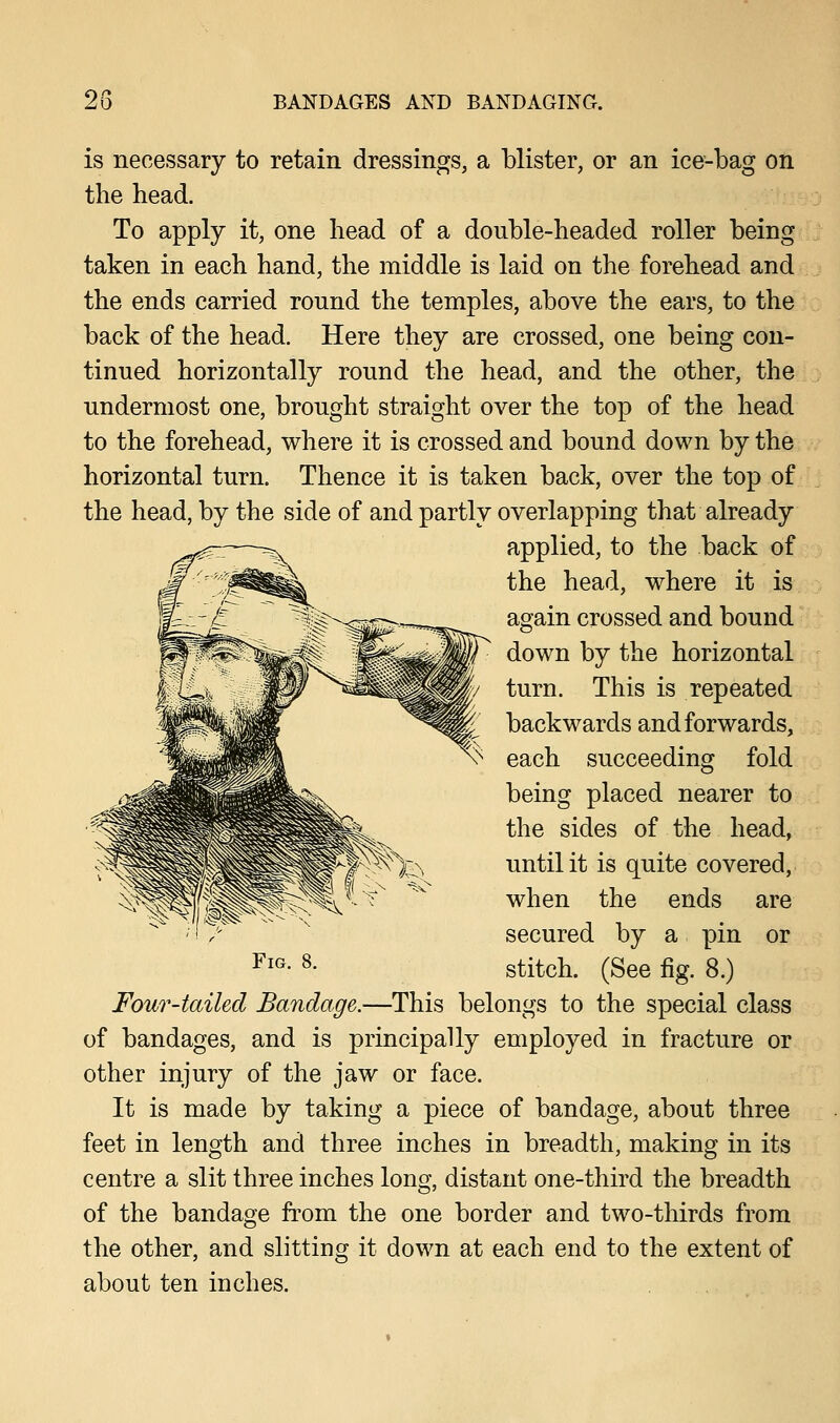 is necessary to retain dressings, a blister, or an ice-bag on the head. To apply it, one head of a double-headed roller being taken in each hand, the middle is laid on the forehead and the ends carried round the temples, above the ears, to the back of the head. Here they are crossed, one being con- tinued horizontally round the head, and the other, the undermost one, brought straight over the top of the head to the forehead, where it is crossed and bound down by the horizontal turn. Thence it is taken back, over the top of the head, by the side of and partly overlapping that already applied, to the back of the head, where it is again crossed and bound down by the horizontal turn. This is repeated backwards and forwards, each succeeding fold being placed nearer to the sides of the head, until it is quite covered, when the ends are secured by a pin or stitch. (See fig. 8.) Four-tailed Bandage.—This belongs to the special class of bandages, and is principally employed in fracture or other injury of the jaw or face. It is made by taking a piece of bandage, about three feet in length and three inches in breadth, making in its centre a slit three inches long, distant one-third the breadth of the bandage from the one border and two-thirds from the other, and slitting it down at each end to the extent of about ten inches.