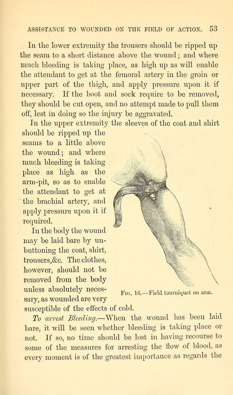 In the lower extremity the trousers should be ripped up the seam to a short distance above the wound; and where much bleeding is taking place, as high up as will enable the attendant to get at the femoral artery in the groin or upper part of the thigh, and apply pressure upon it if necessary. If the boot and sock require to be removed, they should be cut open, and no attempt made to pull them off, lest in doing so the injury be aggravated. In the upper extremity the sleeves of the coat and shirt should be ripped up the seams to a little above the wound; and where much bleeding is taking place as high as the arm-pit, so as to enable the attendant to get at the brachial artery, and mi MWI apply pressure upon it if '1 required. In the body the wound may be laid bare by un- buttoning the coat, shirt, \ trousers,&c. The clothes, (v\ however, should not be V removed from the body \ \ unless absolutely neces- F^ 16>_Field Umn^0li aim sary, as wounded are very susceptible of the effects of cold. To arrest Bleeding.—When the wound has been laid bare, it will be seen whether bleeding is taking place or not. If so, no time should be lost in having recourse to some of the measures for arresting the flow of blood, as every moment is of the greatest importance as regards the