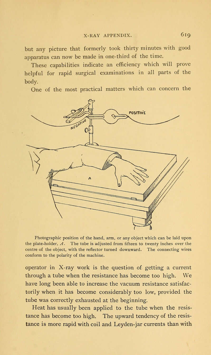 but any picture that formerly took thirty minutes with good apparatus can now be made in one-third of the time. These capabilities indicate an efficiency which will prove helpful for rapid surgical examinations in all parts of the body. One of the most practical matters which can concern the Photographic position of the hand, arm, or any object which can be laid upon the plate-holder, A. The tube is adjusted from fifteen to twenty inches over the centre of the object, with the reflector turned downward. The connecting wires conform to the polarity of the machine. operator in X-ray work is the question of getting a current through a tube when the resistance has become too high. We have long been able to increase the vacuum resistance satisfac- torily when it has become considerably too low, provided the tube was correctly exhausted at the beginning. Heat has usually been applied to the tube when the resis- tance has become too high. The upward tendency of the resis- tance is more rapid with coil and Leyden-jar currents than with