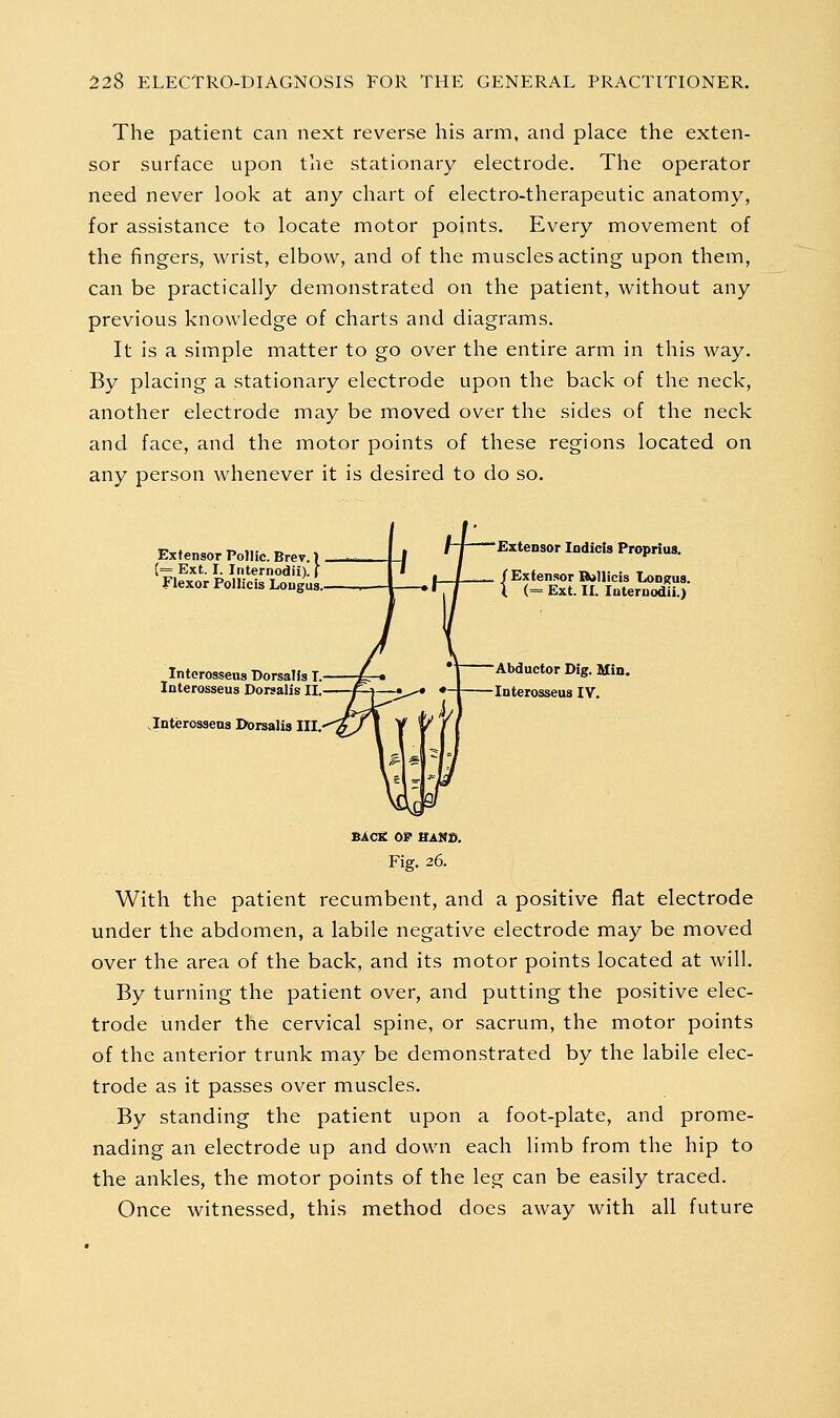 The patient can next reverse his arm, and place the exten- sor surface upon the stationary electrode. The operator need never look at any chart of electro-therapeutic anatomy, for assistance to locate motor points. Every movement of the fingers, wrist, elbow, and of the muscles acting upon them, can be practically demonstrated on the patient, without any previous knowledge of charts and diagrams. It is a simple matter to go over the entire arm in this way. By placing a stationary electrode upon the back of the neck, another electrode may be moved over the sides of the neck and face, and the motor points of these regions located on any person whenever it is desired to do so. Extensor Pollic. Brev. 1 _— [= Ext. I. Internodii). ( Flexor Pollicis Longus. Intcrosseus DorsaUs T. Interosseus Dorsalis II. Jnterosseus Dorsalis III, Extensor Indicis Proprius. / Extensor Bollicis Longus. (. (= Ext. II. Internodii.) Abductor Dig. Min. Interosseus IV. BACK OS HAMS. Fig. 26. With the patient recumbent, and a positive flat electrode under the abdomen, a labile negative electrode may be moved over the area of the back, and its motor points located at will. By turning the patient over, and putting the positive elec- trode under the cervical spine, or sacrum, the motor points of the anterior trunk may be demonstrated by the labile elec- trode as it passes over muscles. By standing the patient upon a foot-plate, and prome- nading an electrode up and down each limb from the hip to the ankles, the motor points of the leg can be easily traced. Once witnessed, this method does away with all future